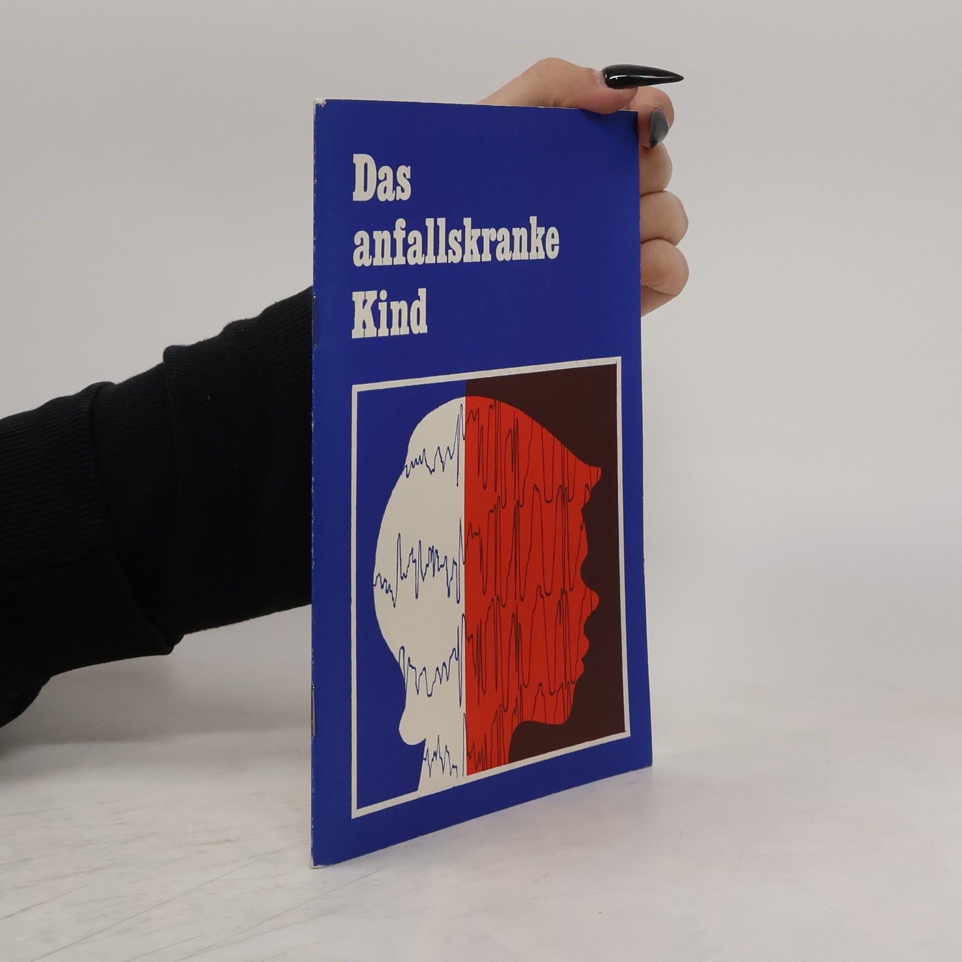 Auteurscollectief Das anfallskranke Kind