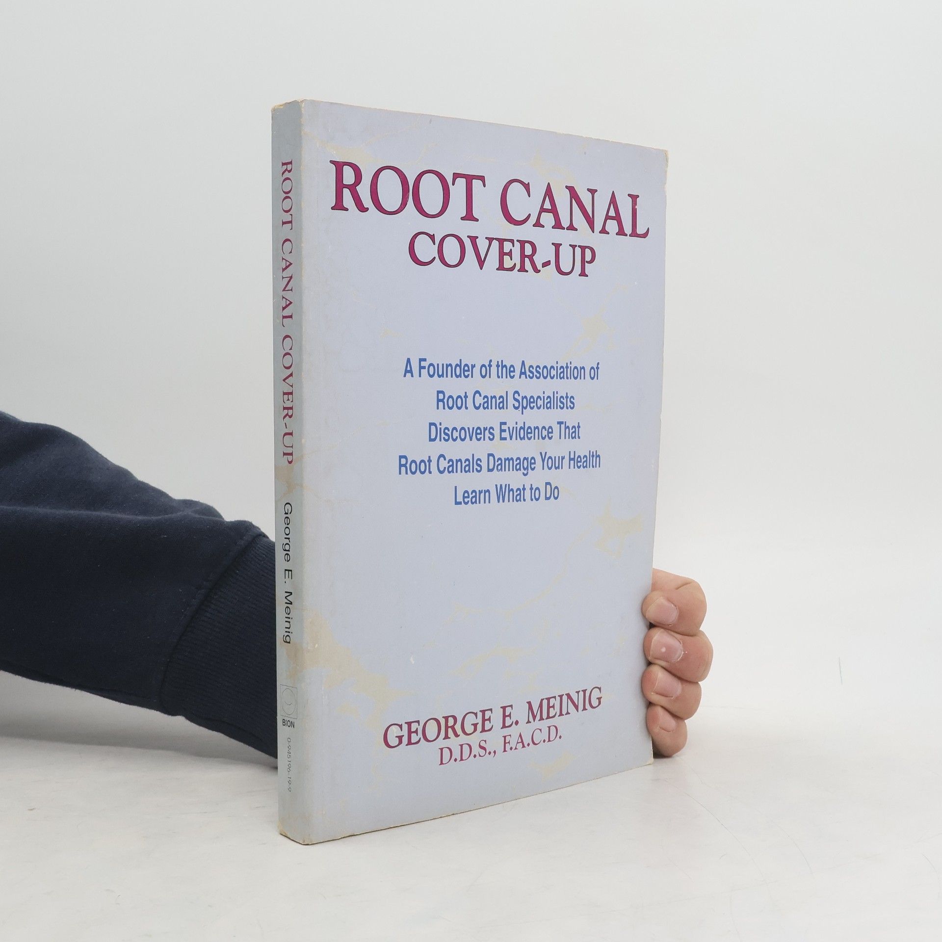 George Meinig Root canal cover-up