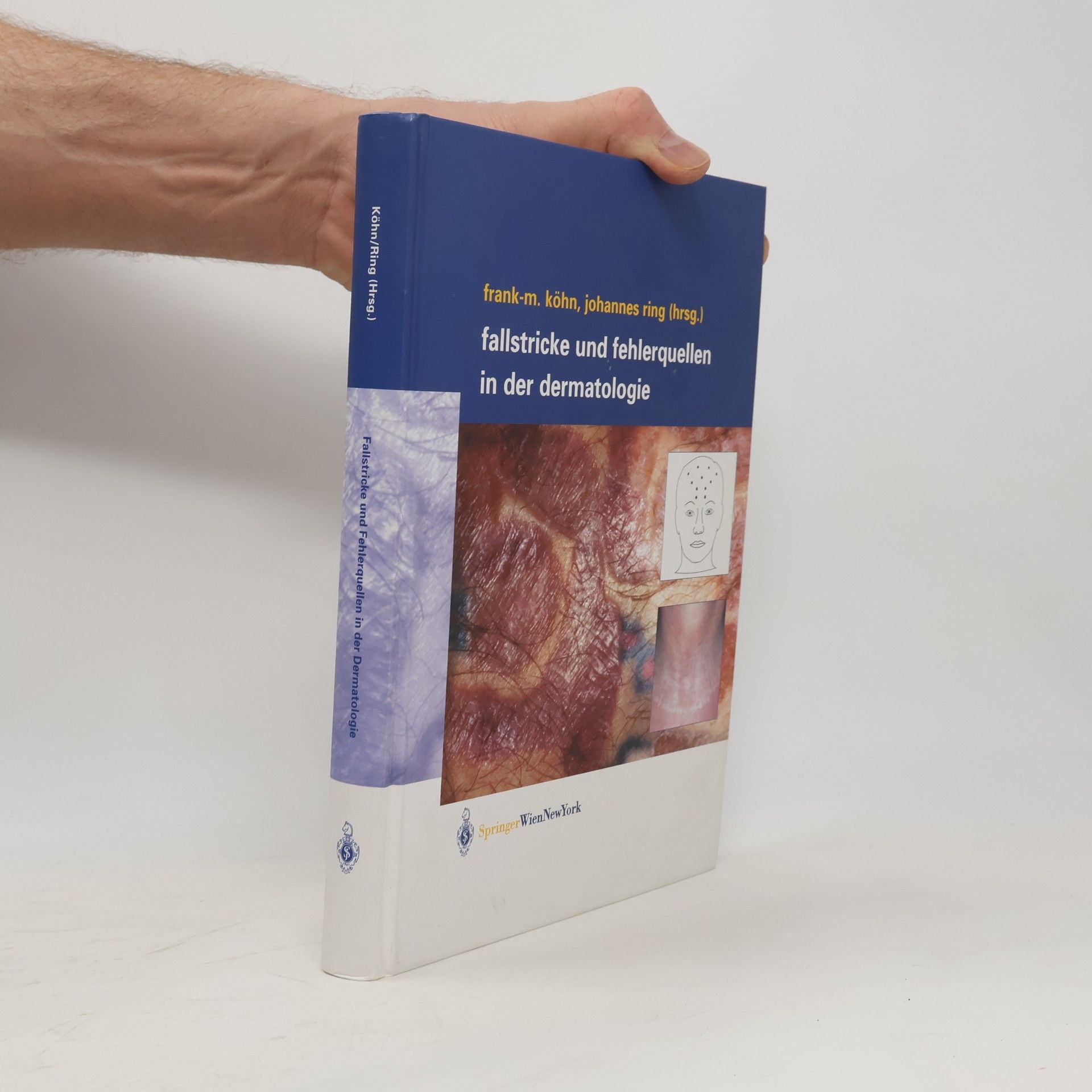 Michael Kohn Fallstricke und Fehlerquellen in der Dermatologie
