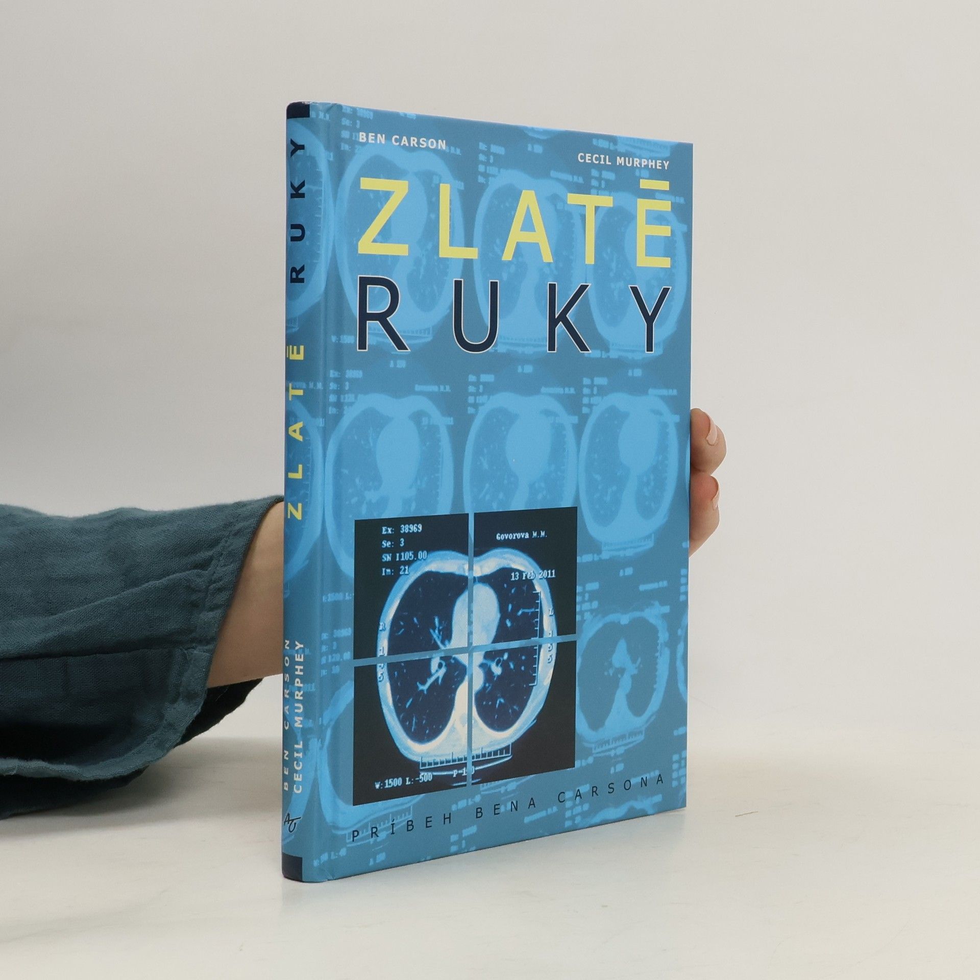 Carson Murphey Zlaté ruky