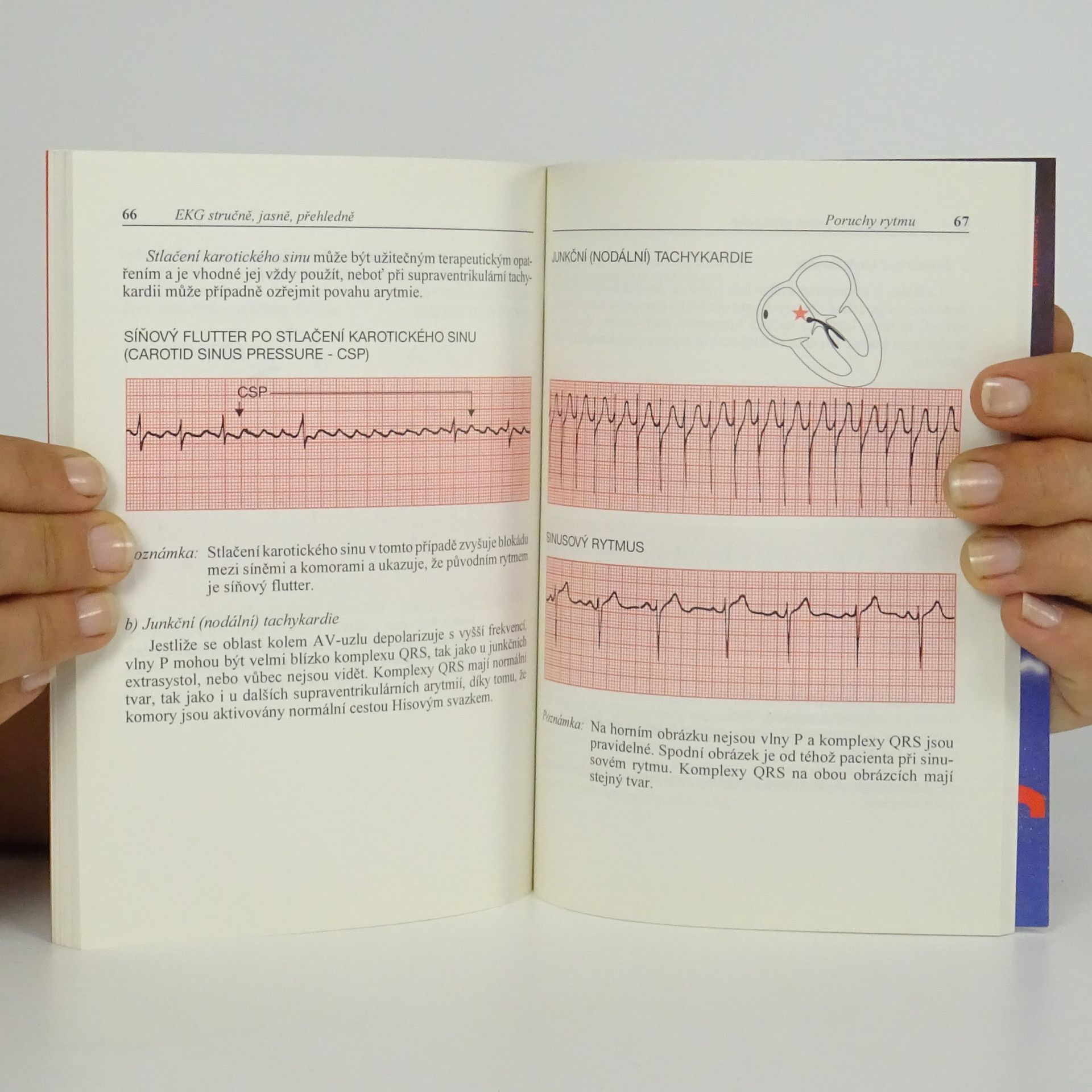 John R. Hampton EKG stručně, jasně, přehledně