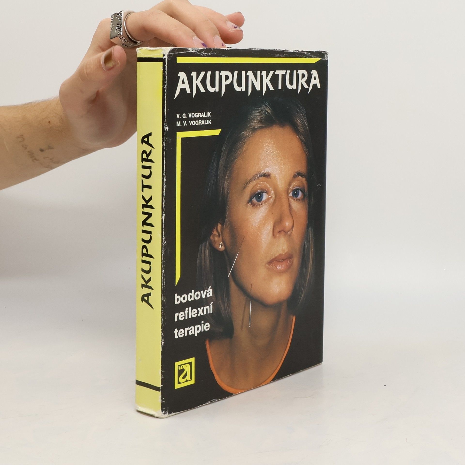 Akupunktura. Bodová reflexní terapie