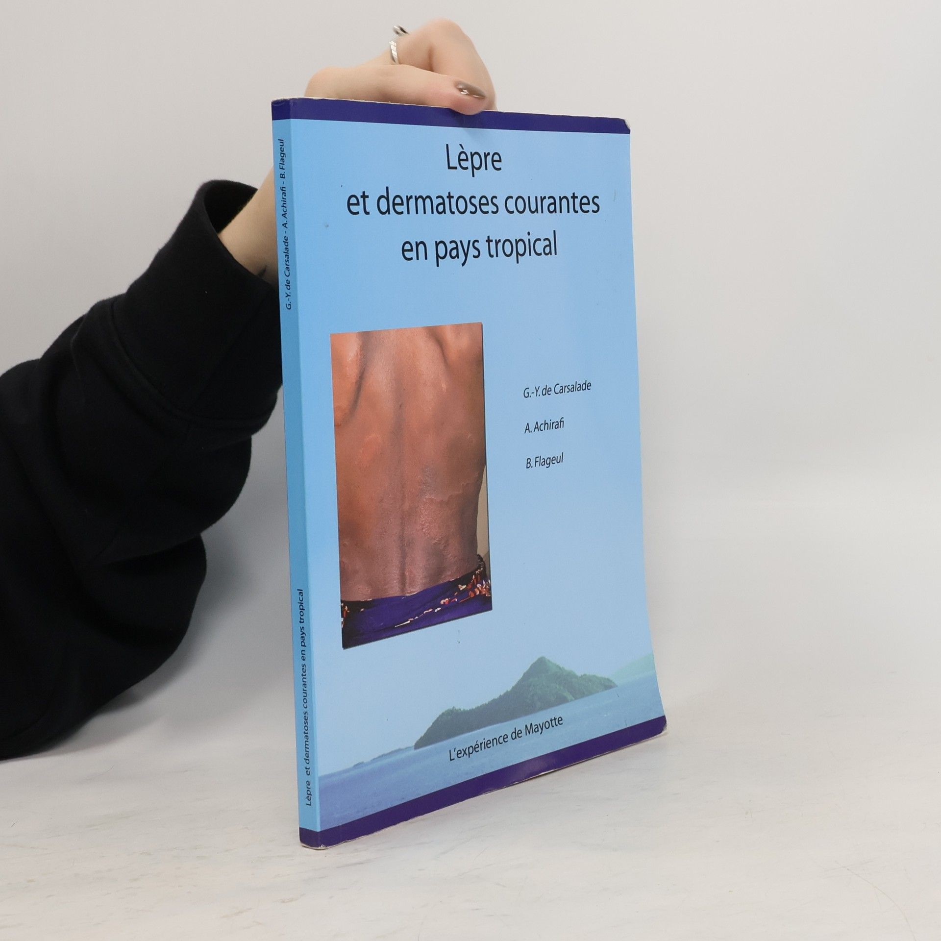 Lèpre et dermatoses courantes en pays tropical