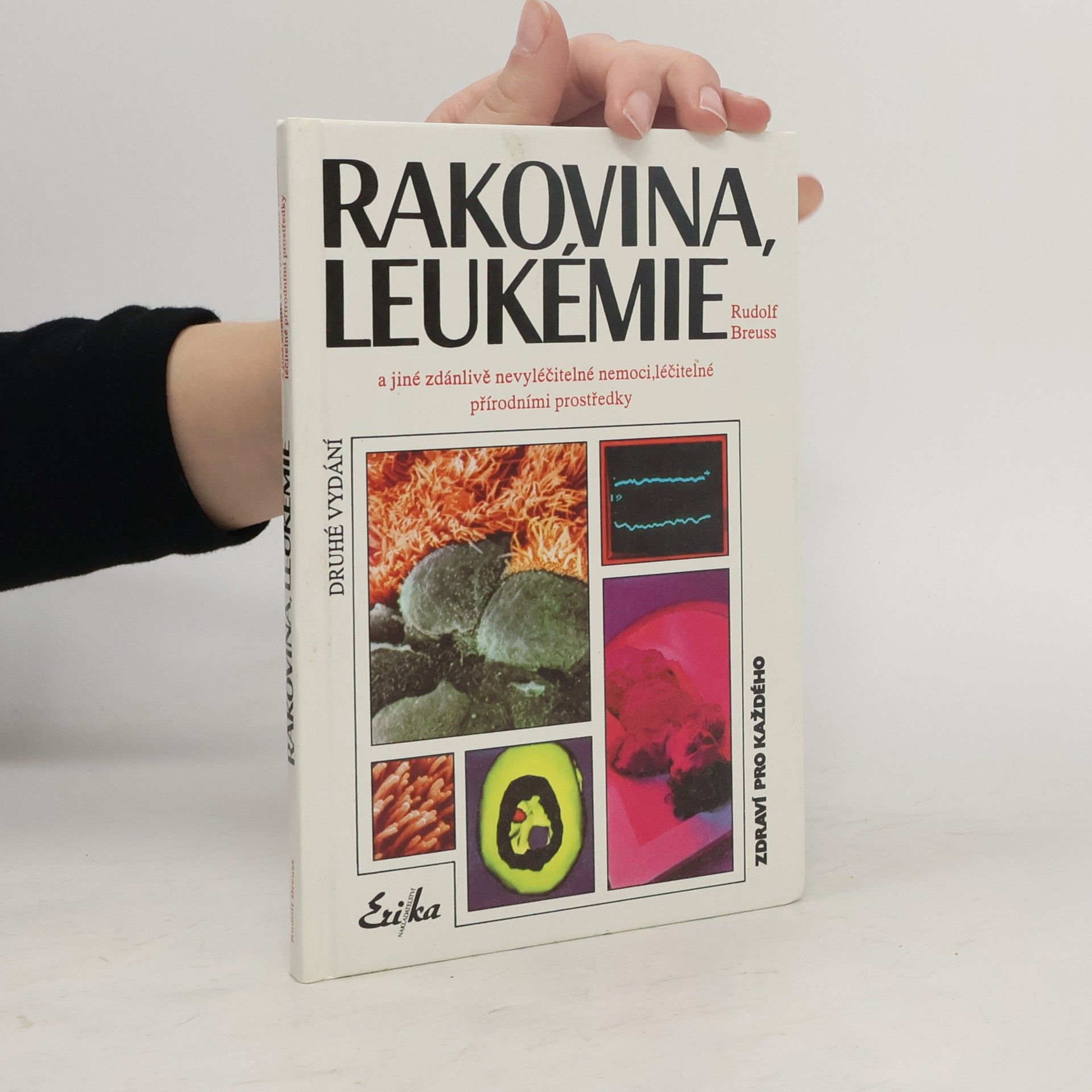Rudolf Breuss Rakovina, leukémie a jiné zdánlivě nevyléčitelné nemoci, které jsou léčitelné přírodními prostředky: Záznamy z tisíců zkušeností k blahu všeho lidstva na přání mnoha vyléčených pacientů a také na přání dobrých lékařů