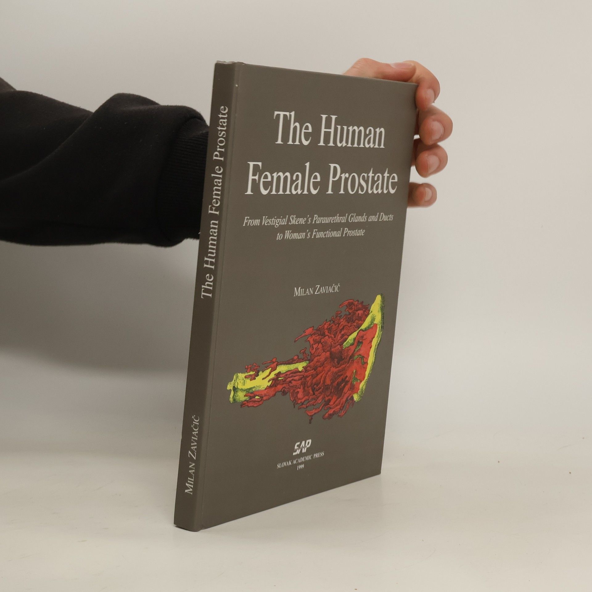 The Human Female Prostate