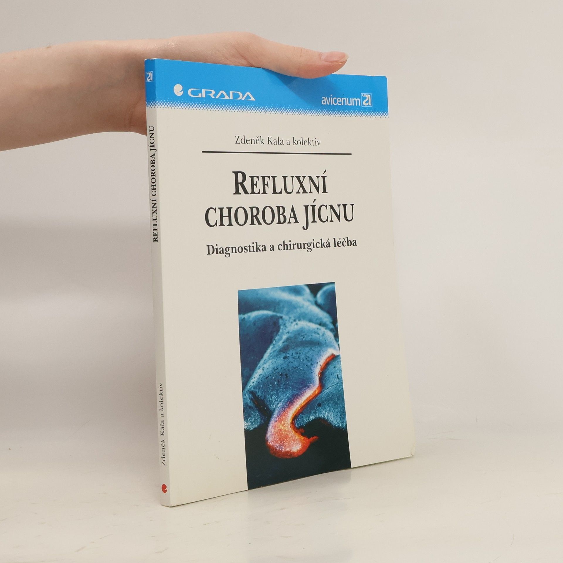 Zdeněk Kala Refluxní choroba jícnu : diagnostika a chirurgická léčba