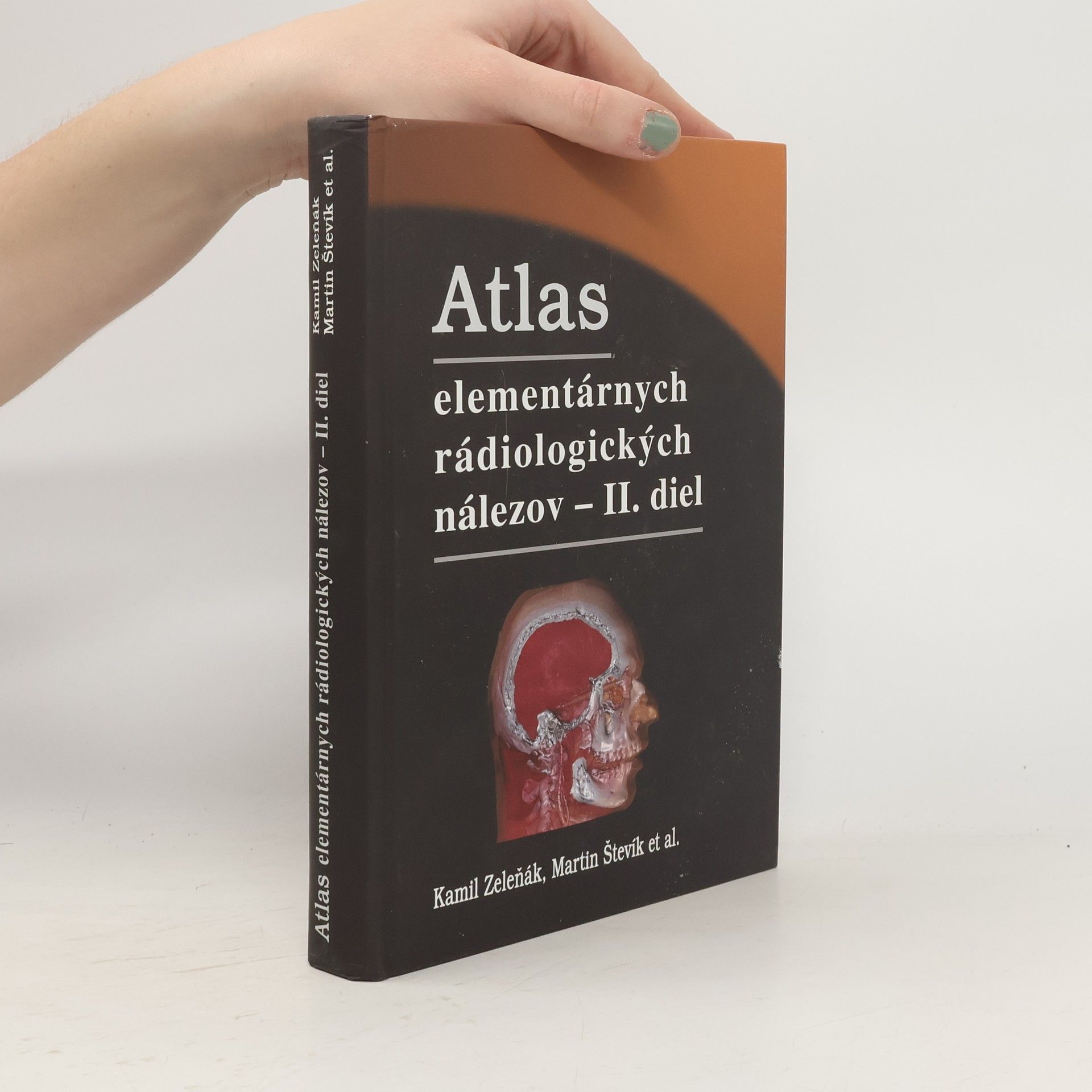 Kamil Zeleňák Atlas elementárnych rádiologických nálezov - II. diel