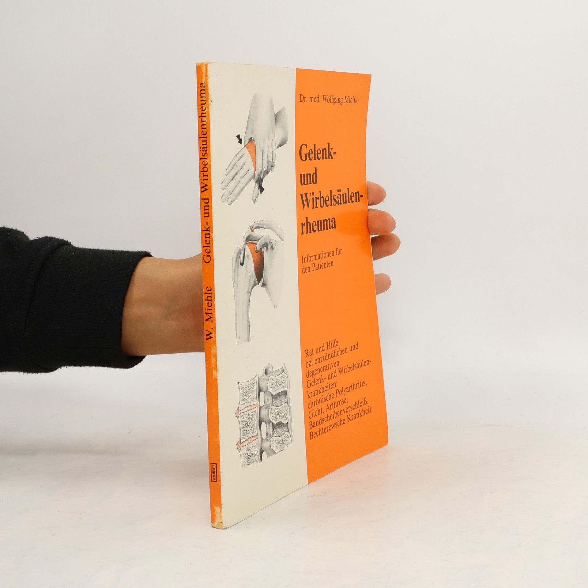 Gelenk- und Wirbelsäulenrheuma