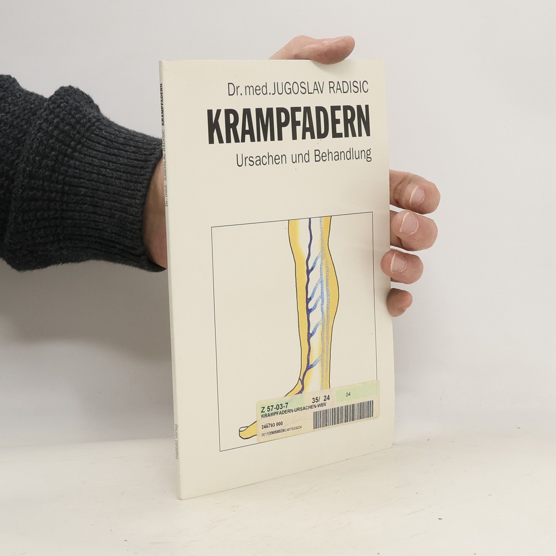 Krampfadern. Ursachen und Behandlung