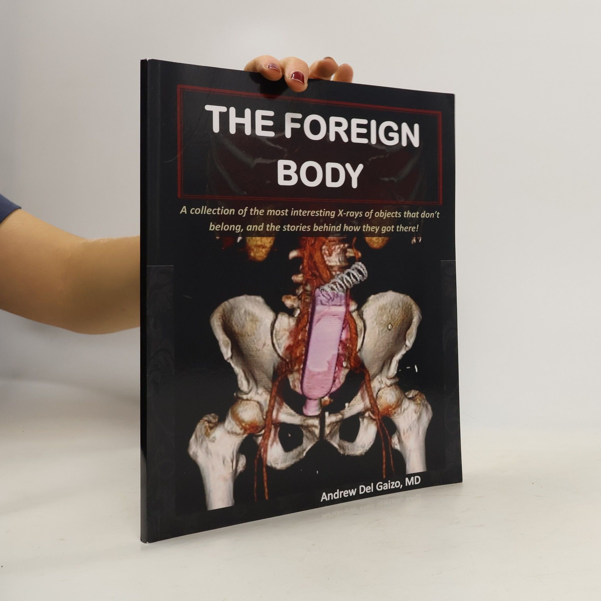 Andrew Del Gaizo The Foreign Body