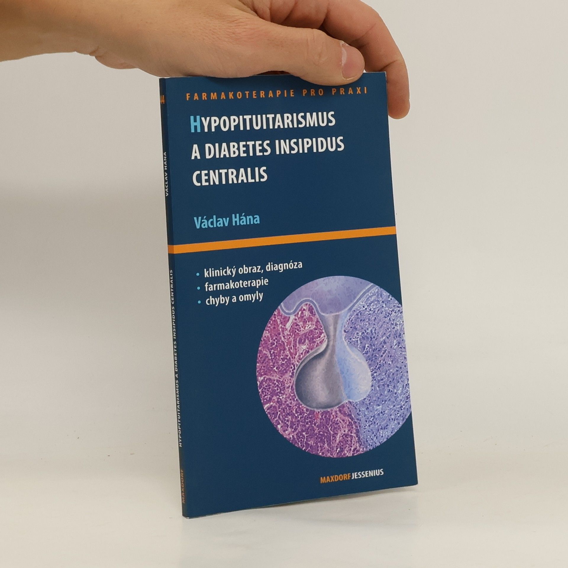 Václav Hána Hypopituitarismus a diabetes insipidus centralis