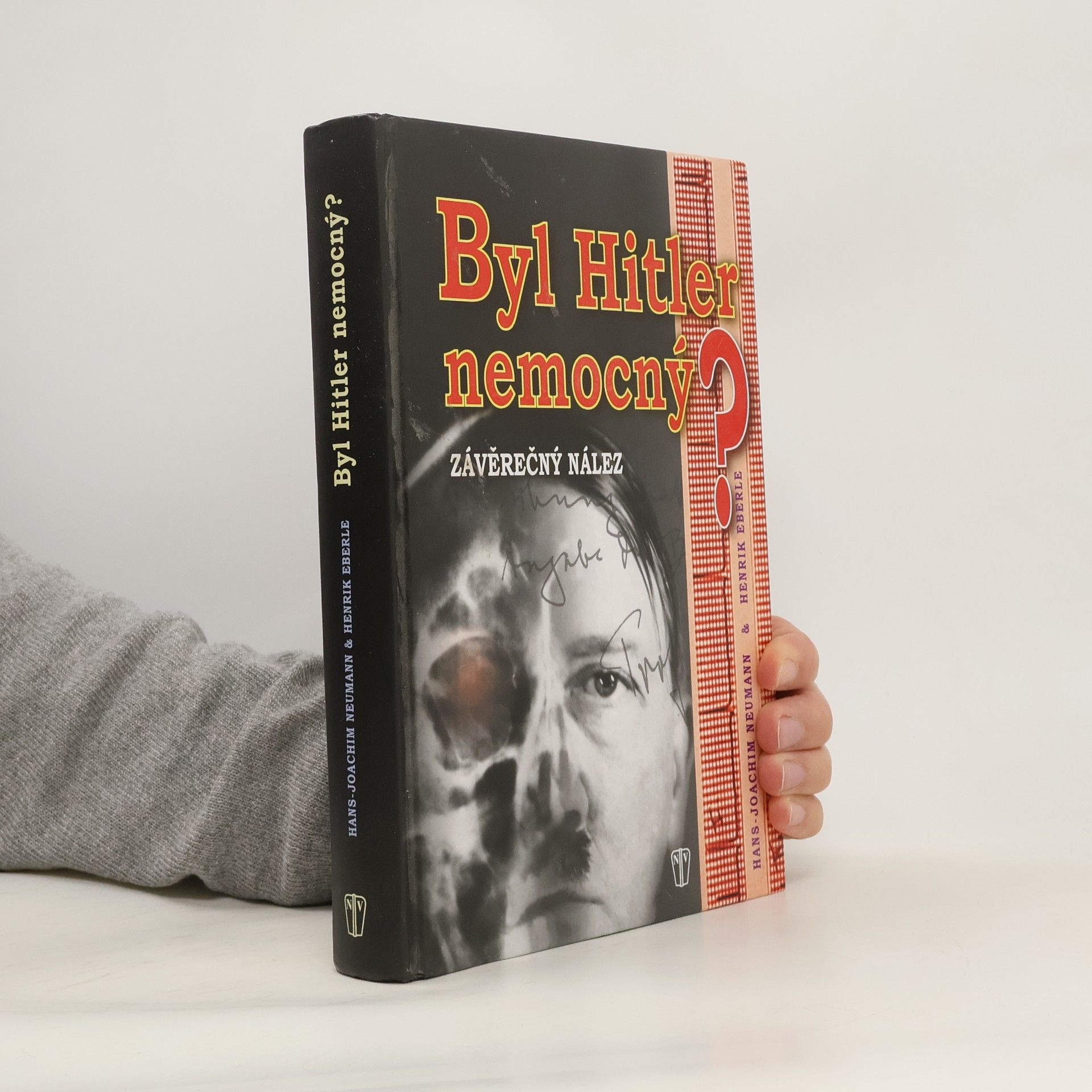 Byl Hitler nemocný? Závěrečný nález