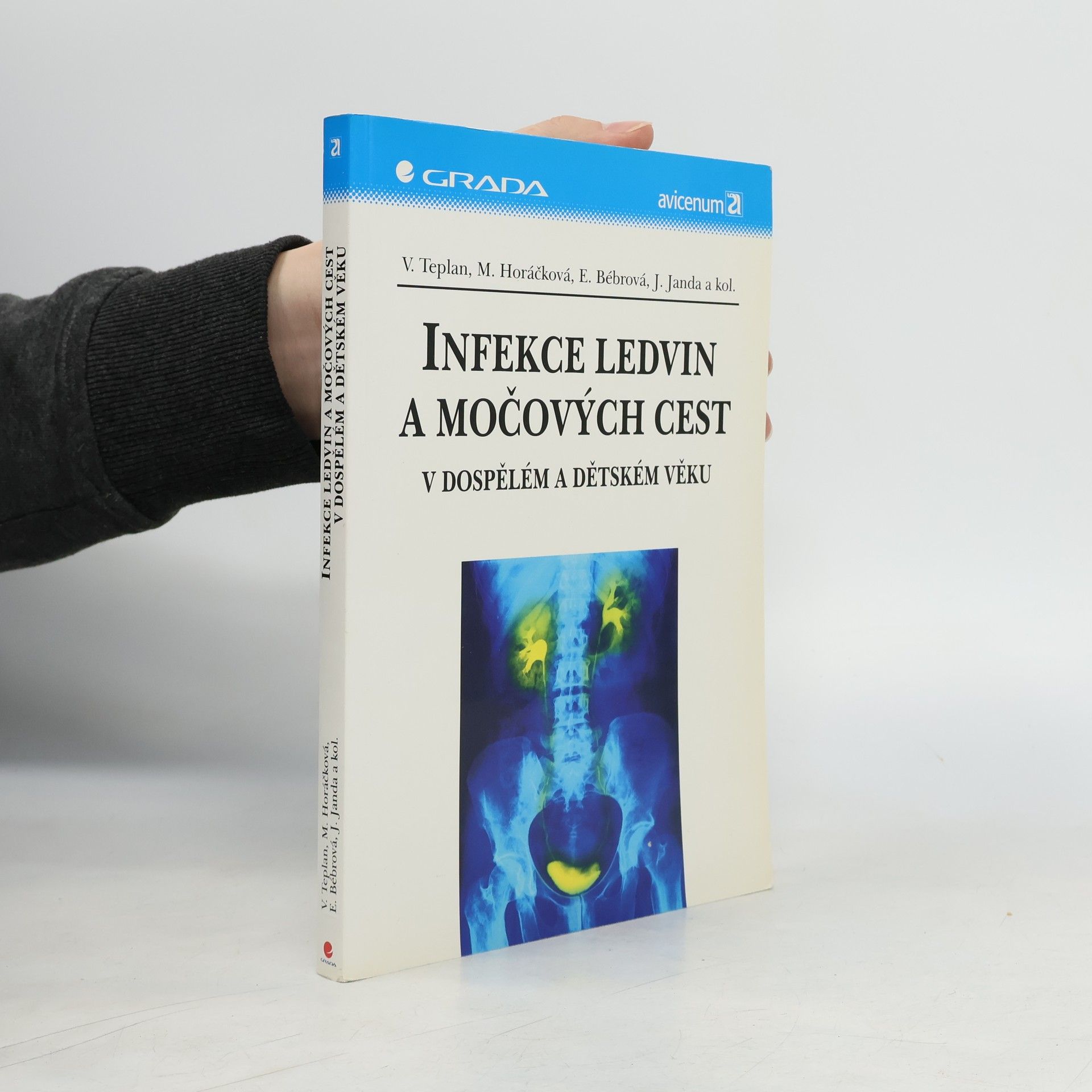 Collectif d'auteurs Infekce ledvin a močových cest v dospělém a dětském věku