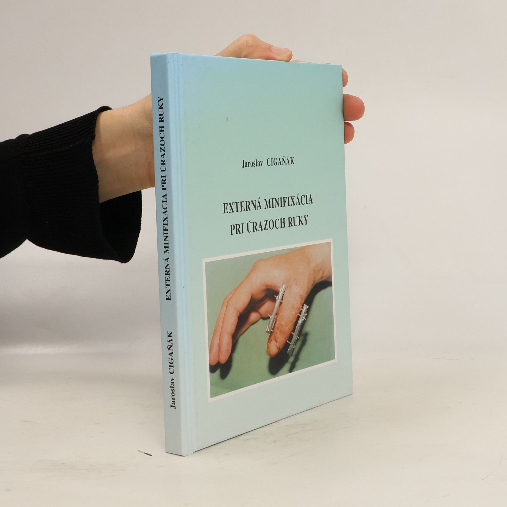 Externá minifixácia pri úrazoch ruky