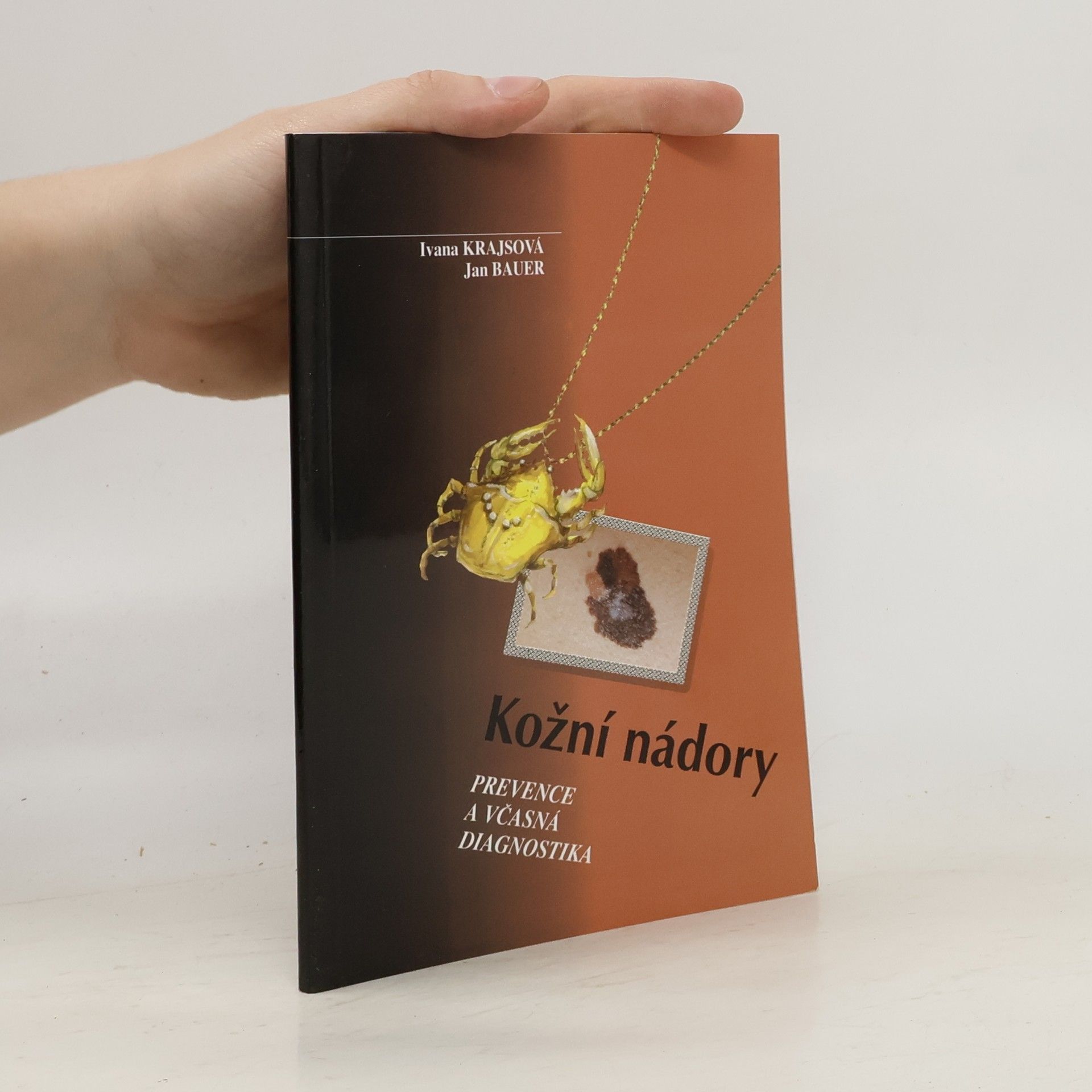 Kožní nádory: Prevence a včasná diagnostika