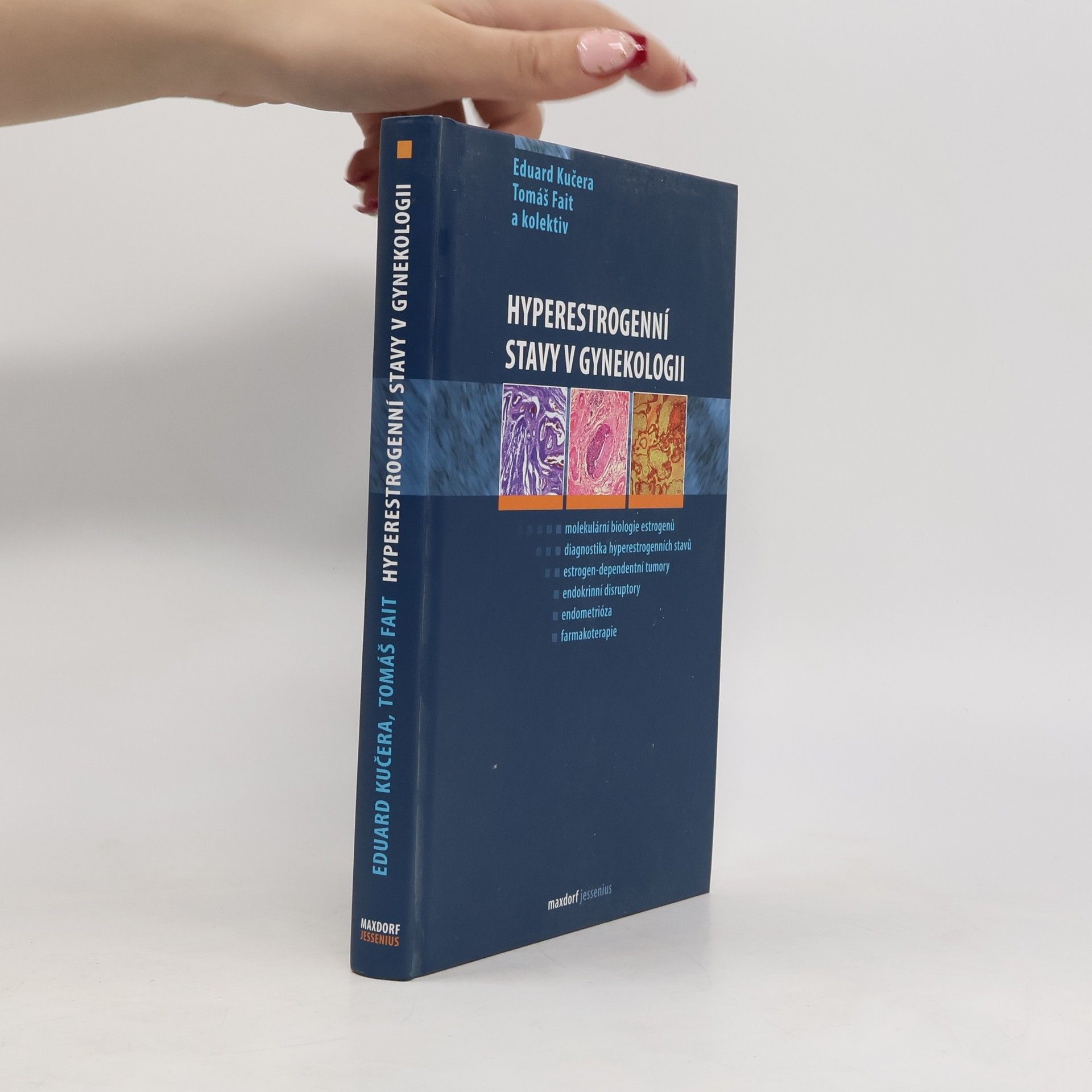 Tomáš Fait Hyperestrogenní stavy v gynekologii
