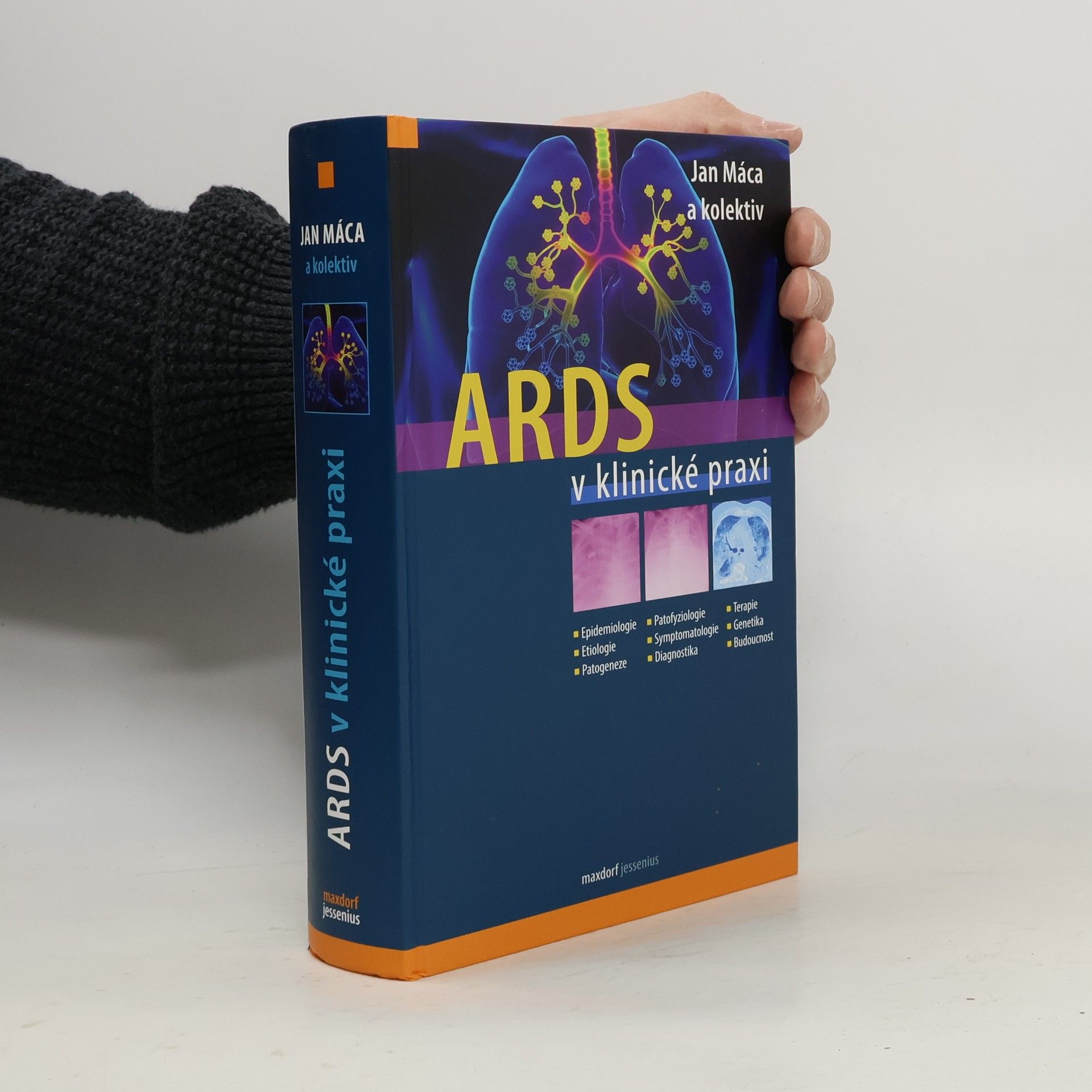 Jan Máca ARDS v klinické praxi