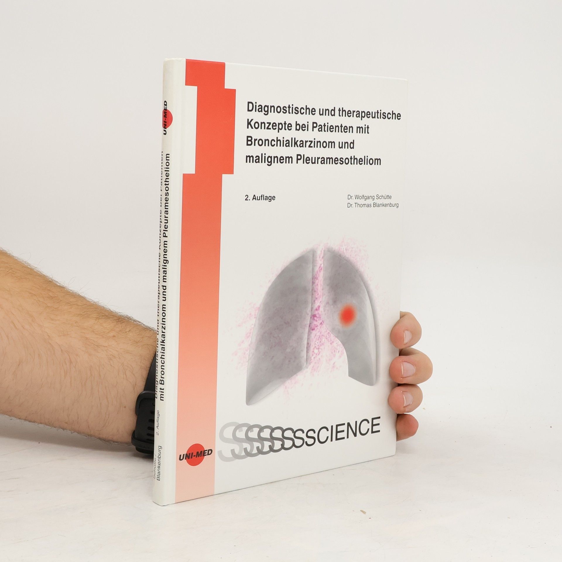 Diagnostische und therapeutische Konzepte bei Patienten mit Bronchialkarzinom und malignem Pleuramesotheliom