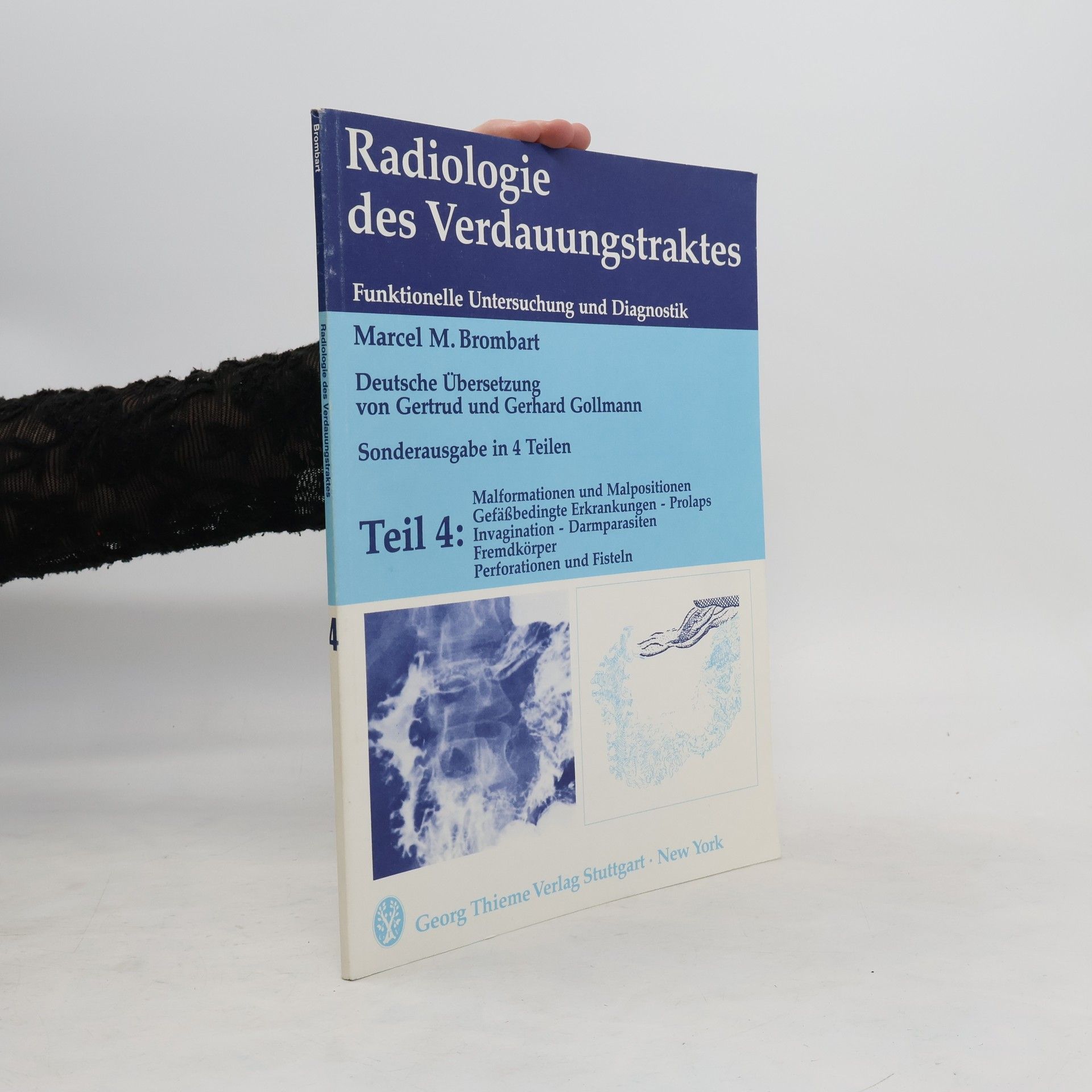 Radiologie des Verdauungstraktes