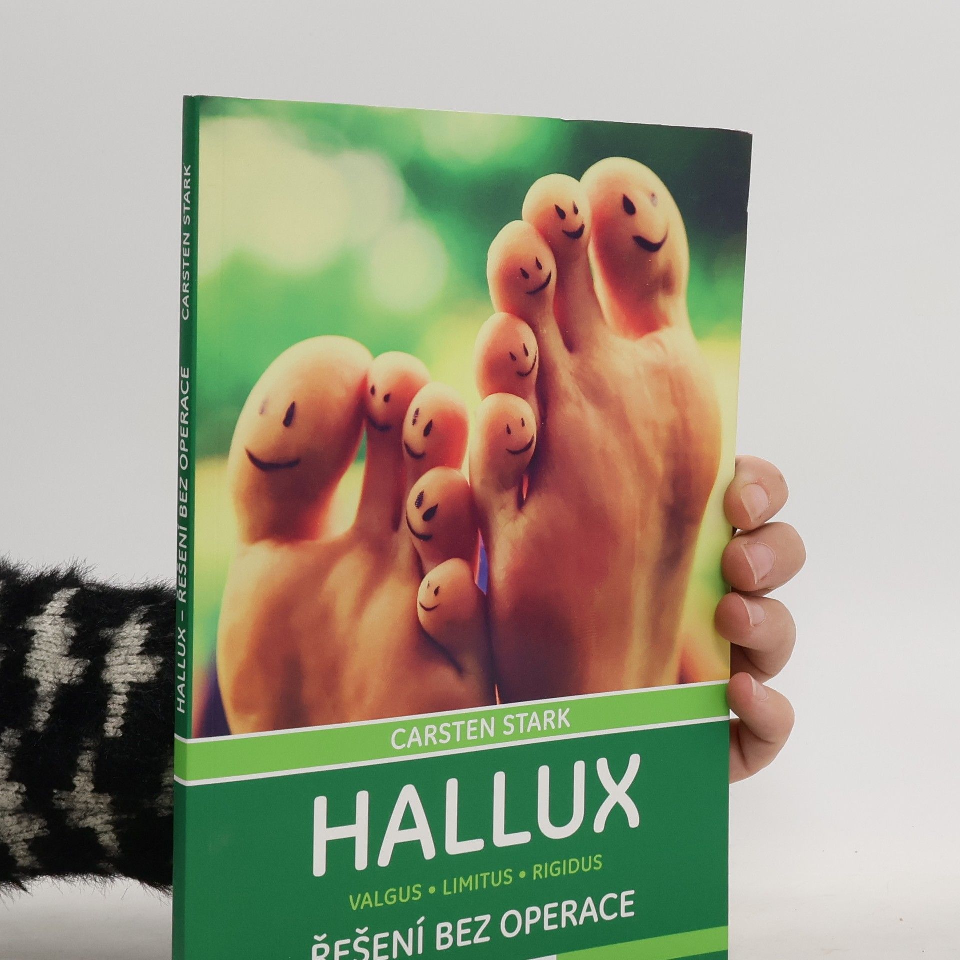 Hallux – řešení bez operace