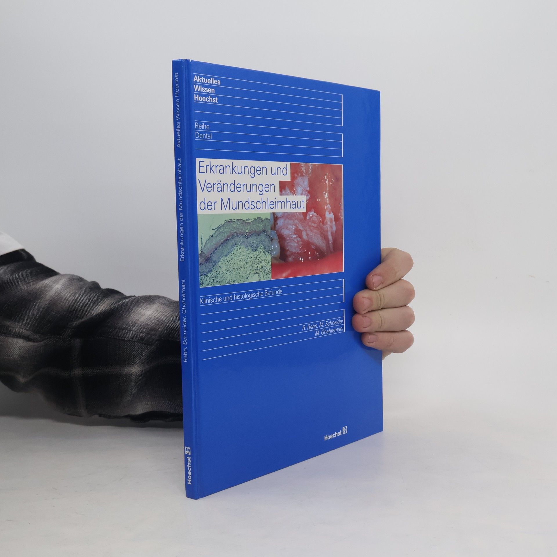 Erkrankungen und Veränderungen der Mundschleimhaut