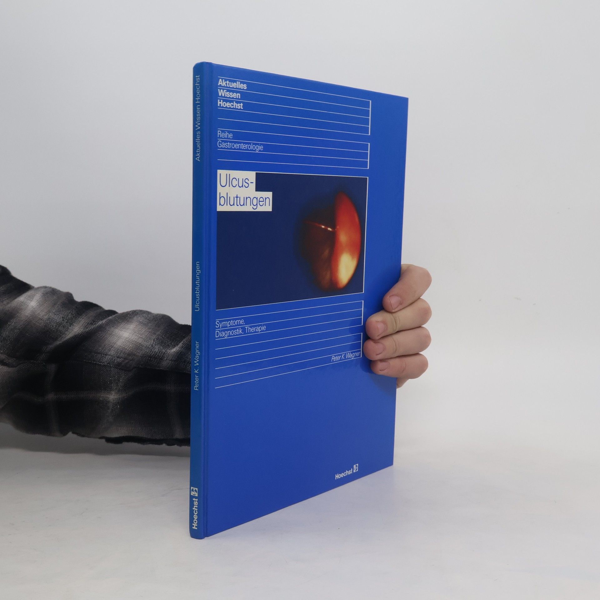 Peter K. Wagner Ulcusblutungen