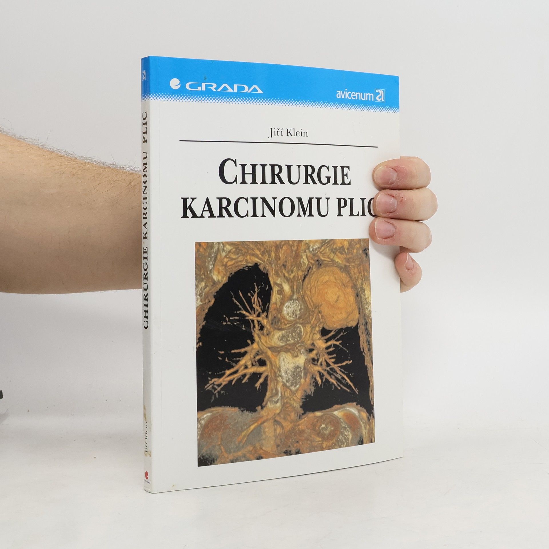 Jiří Klein Chirurgie karcinomu plic