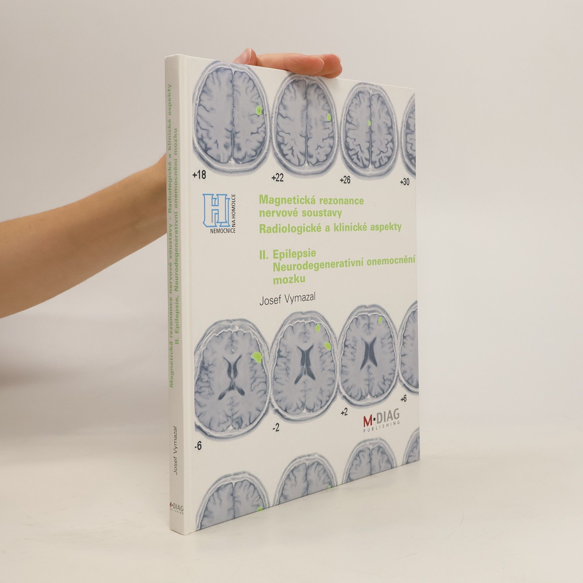 Josef Vymazal Magnetická rezonance nervové soustavy. Radiologické a klinické aspekty. II. Epilepsie. Neurodegenerativní onemocnění mozku