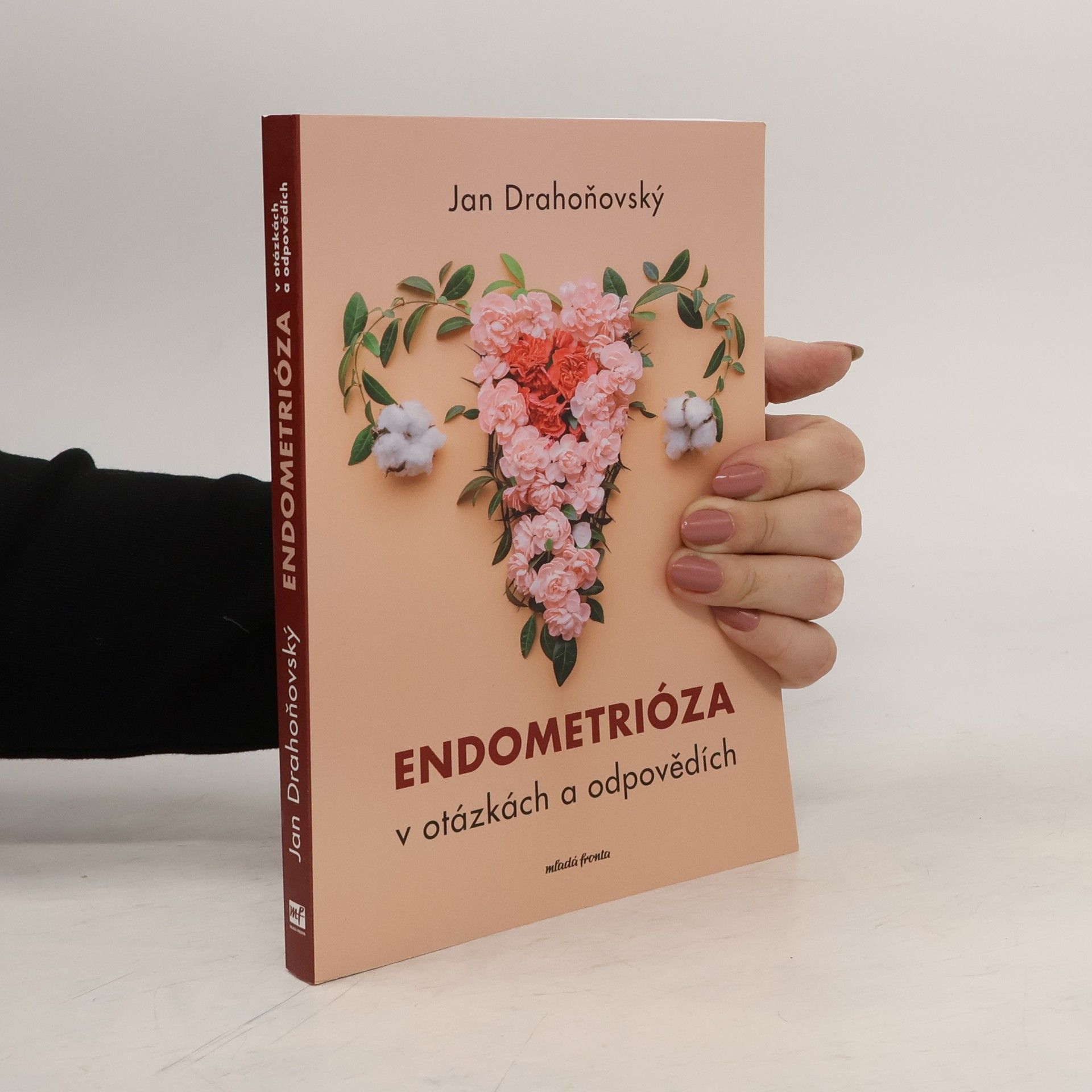 Jan Drahoňovský Endometrióza v otázkách a odpovědích