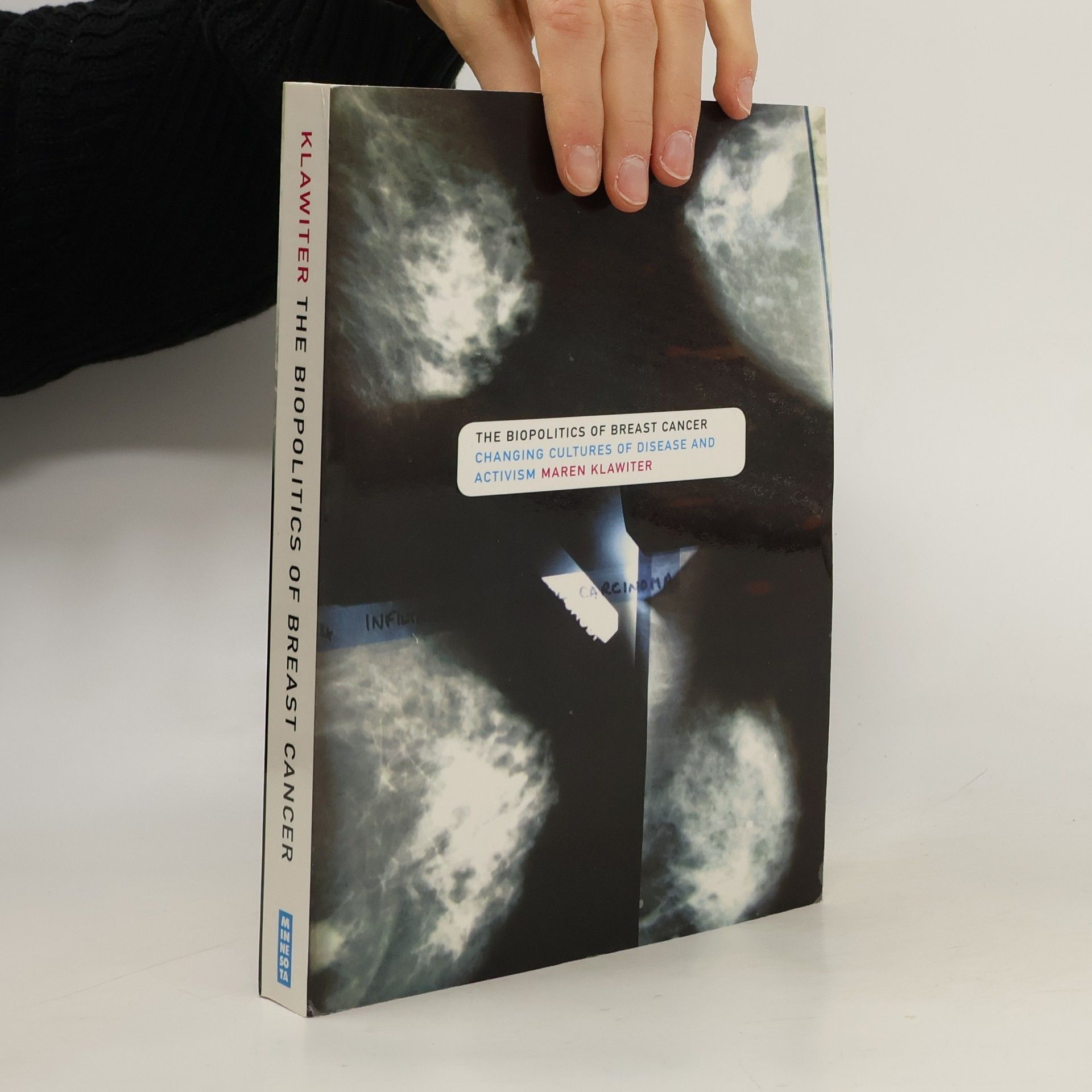 Maren Klawiter The Biopolitics of Breast Cancer