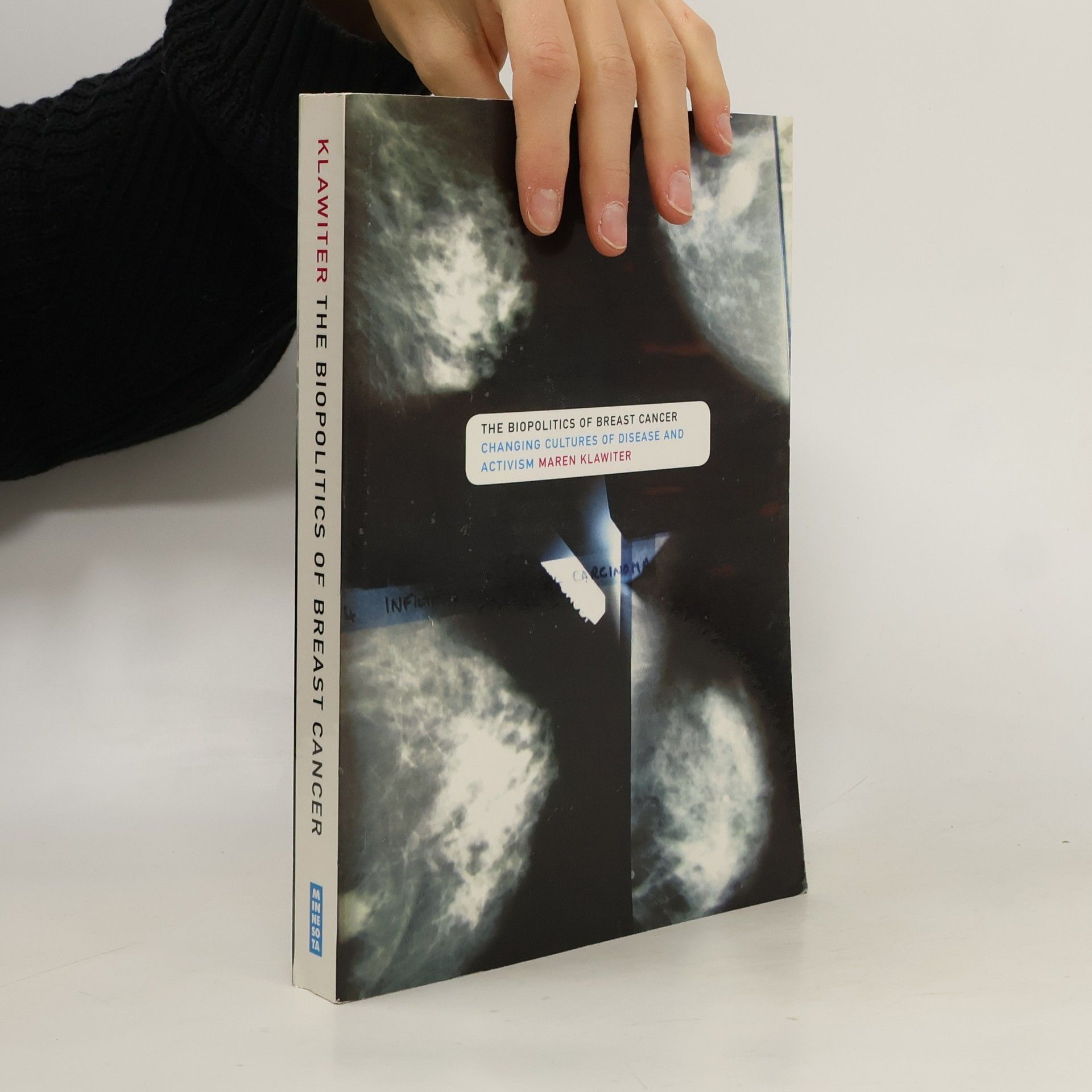 Maren Klawiter The Biopolitics of Breast Cancer