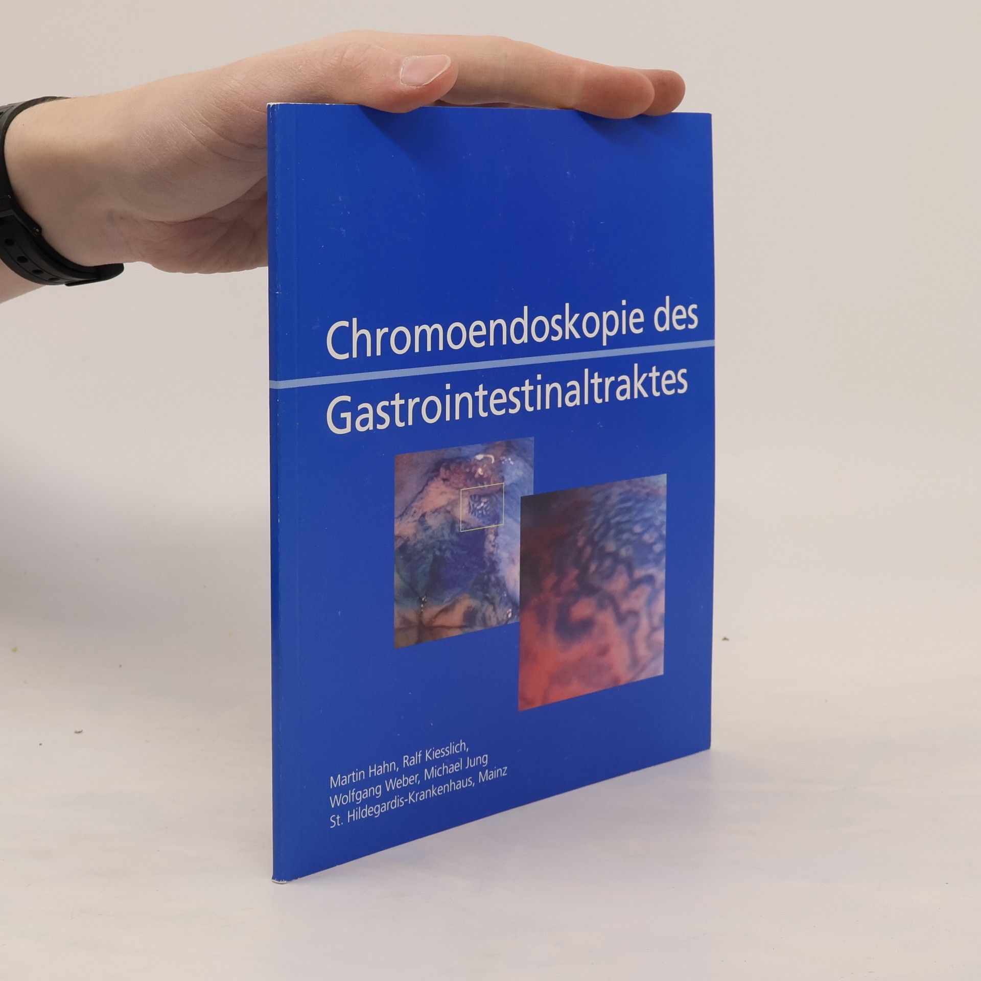 Martin Hahn Chromoendoskopie des Gastrointestinaltraktes