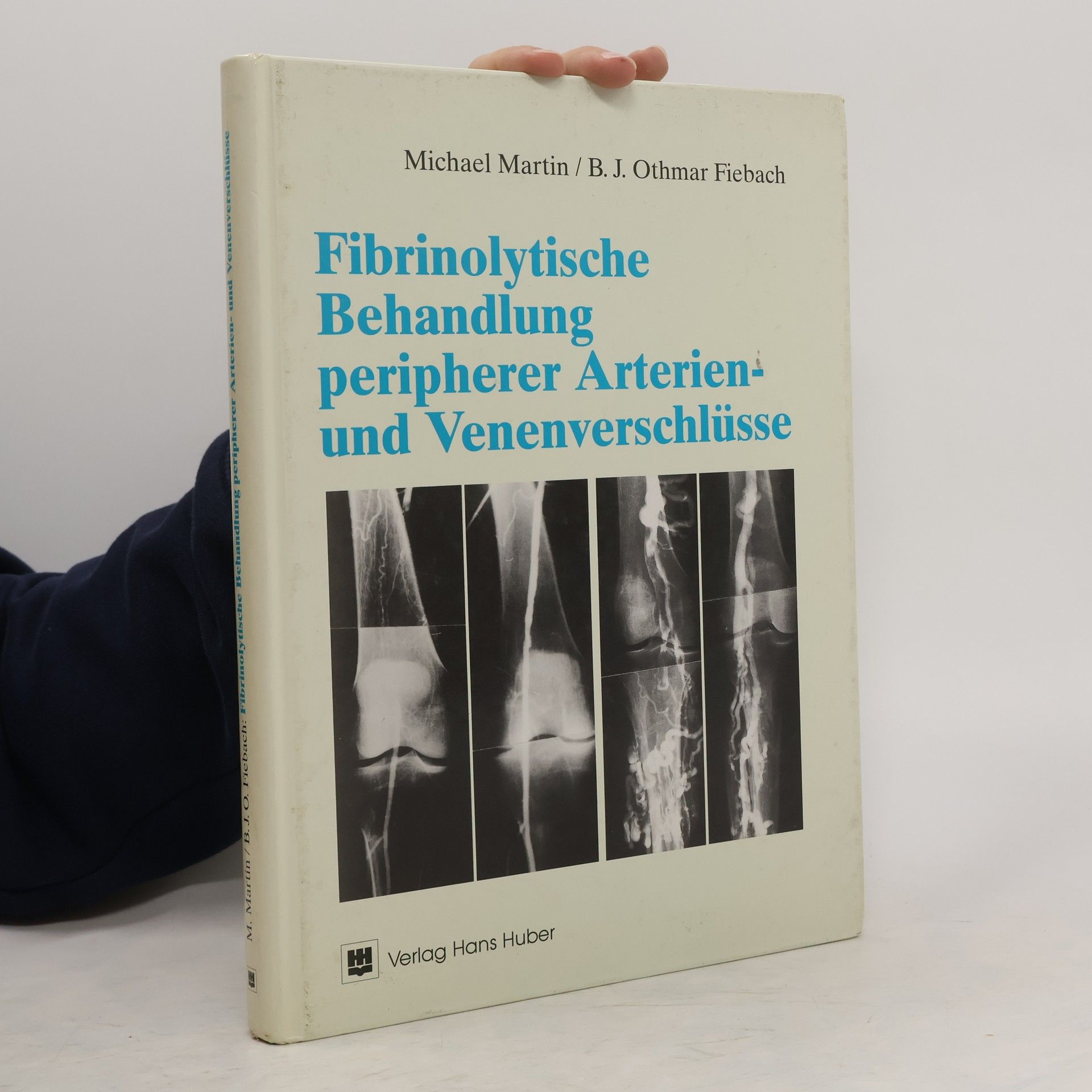 Michael Martin Fibrinolytische Behandlung peripherer Arterien- und Venenverschlüsse