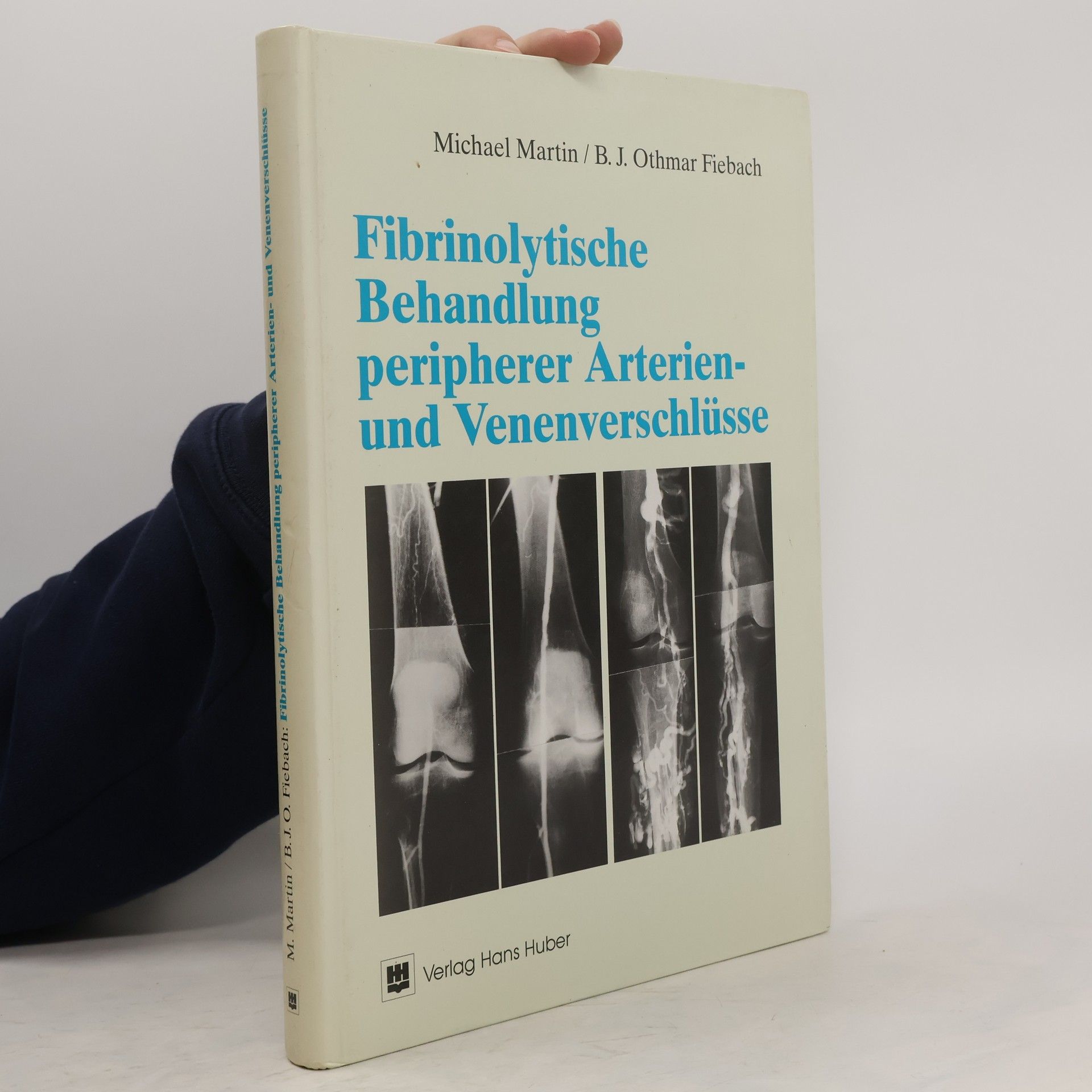 Michael Martin Fibrinolytische Behandlung peripherer Arterien- und Venenverschlüsse