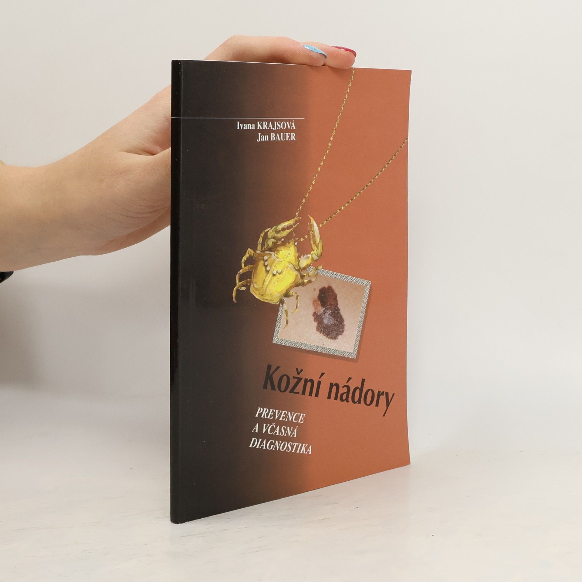 Kožní nádory: Prevence a včasná diagnostika