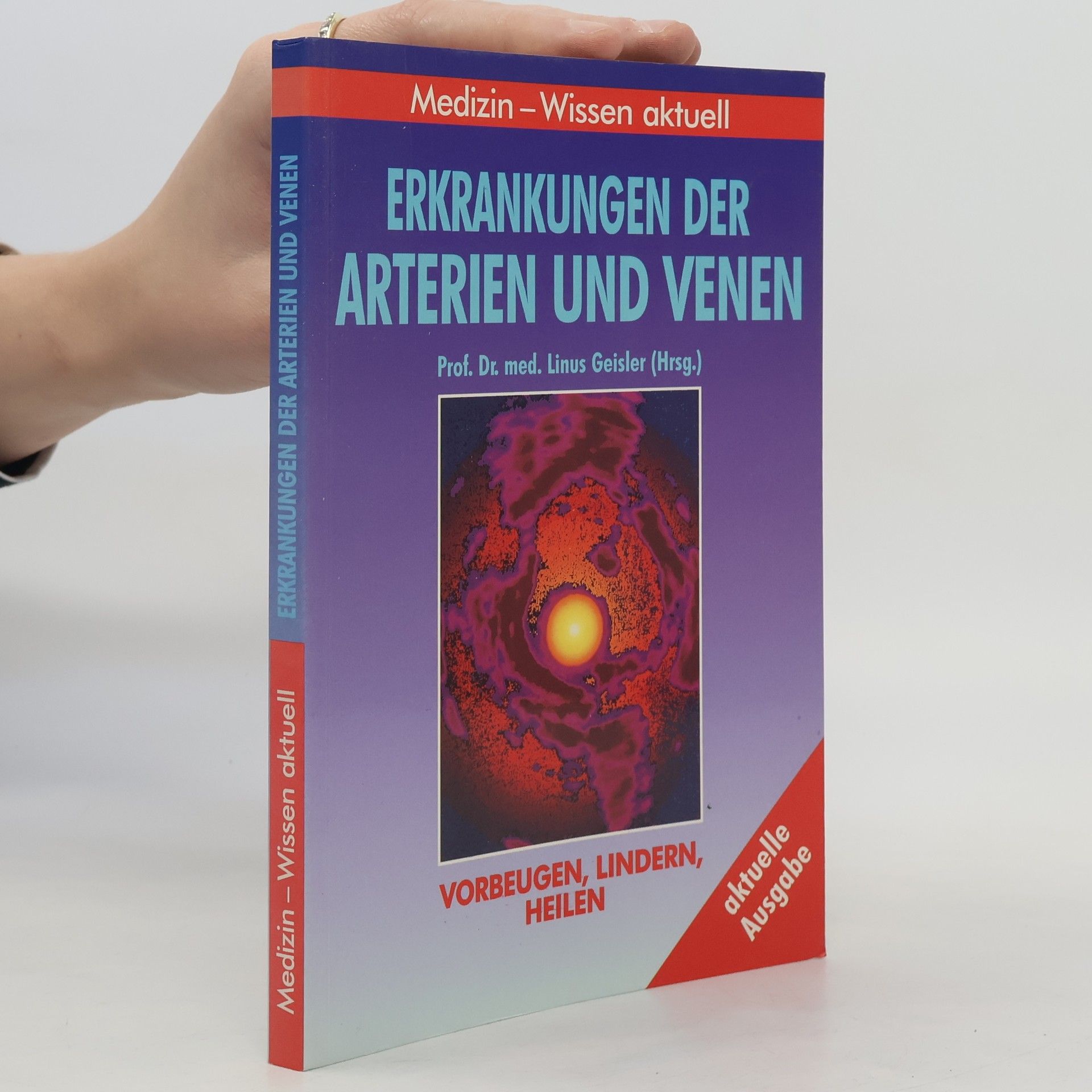 Erkrankungen der Arterien und Venen.