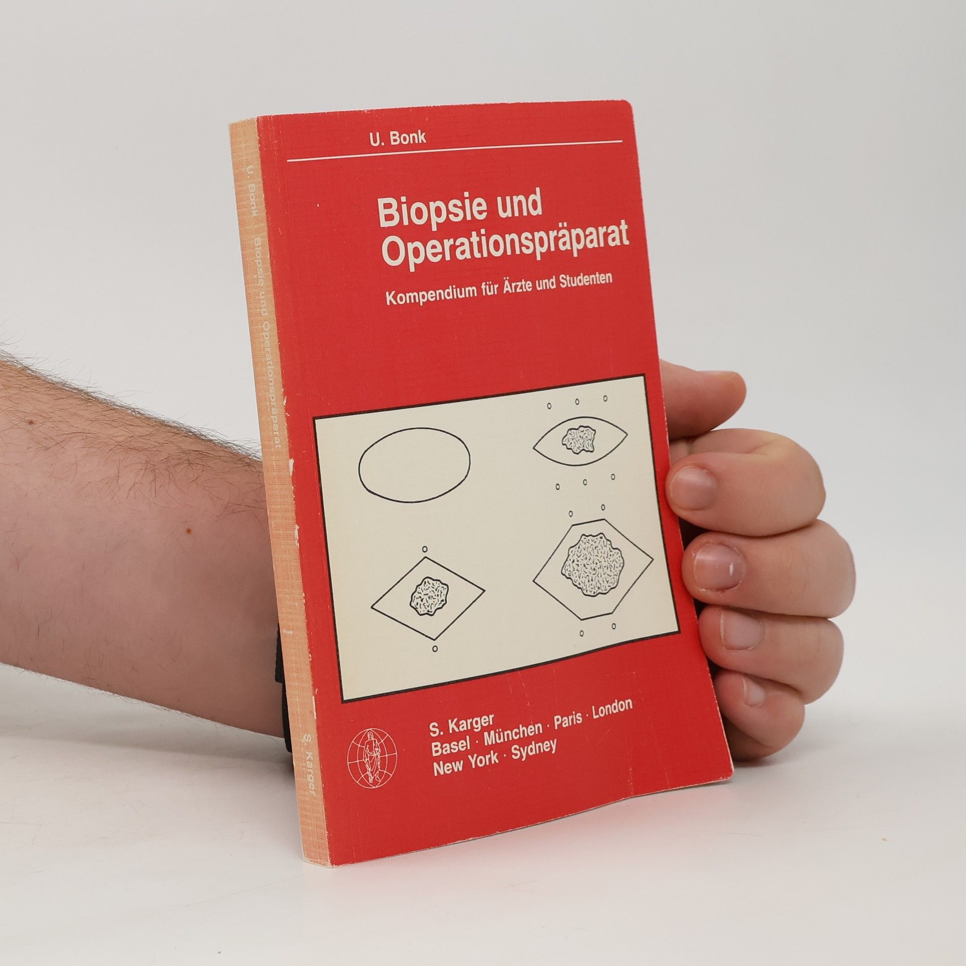 Ulrich E. W. Bonk Biopsie und Operationspräparat