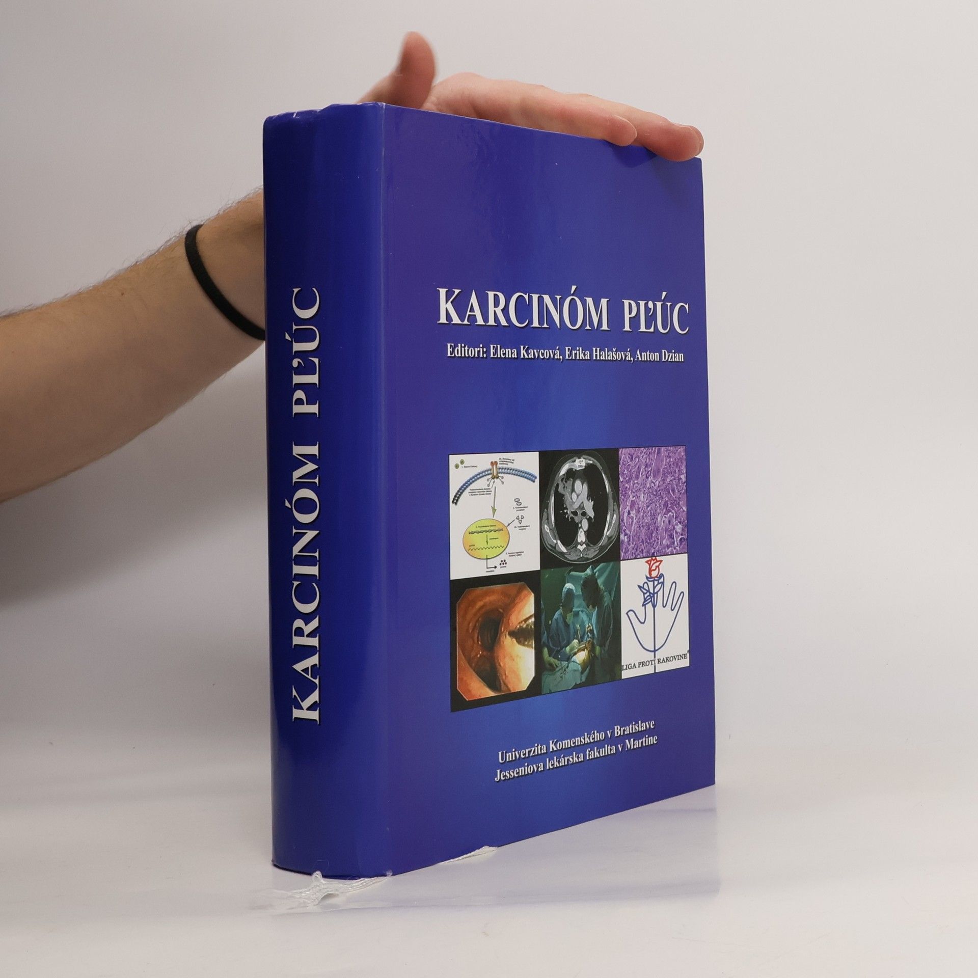 Kolektív autorov Karcinóm pľúc