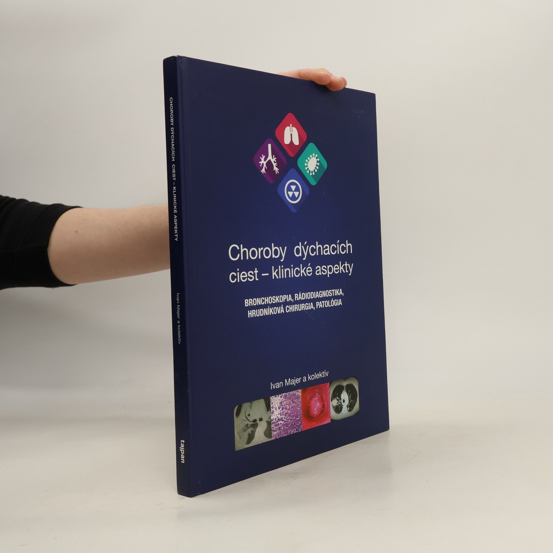Choroby dýchacích ciest - klinické aspekty : bronchoskopia, rádiodiagnotika, hrudníková chirurgia, patológia