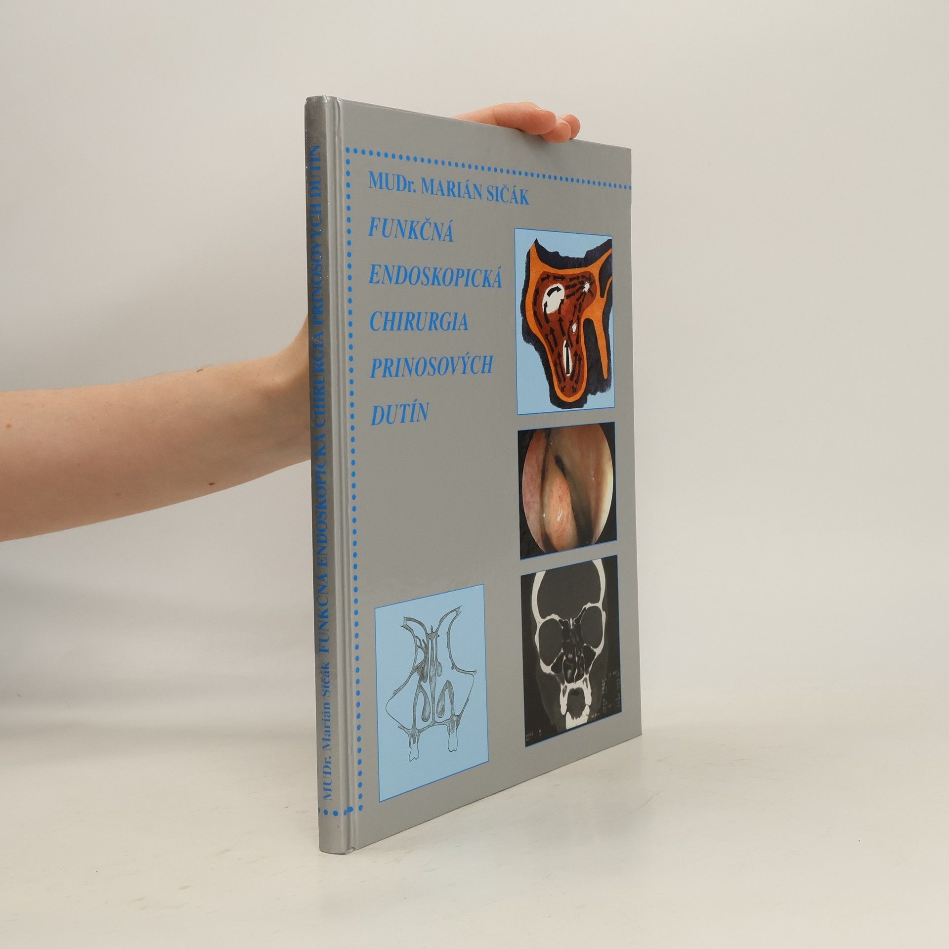 Marián Sičák Funkčná endoskopická chirurgia prinosových dutín