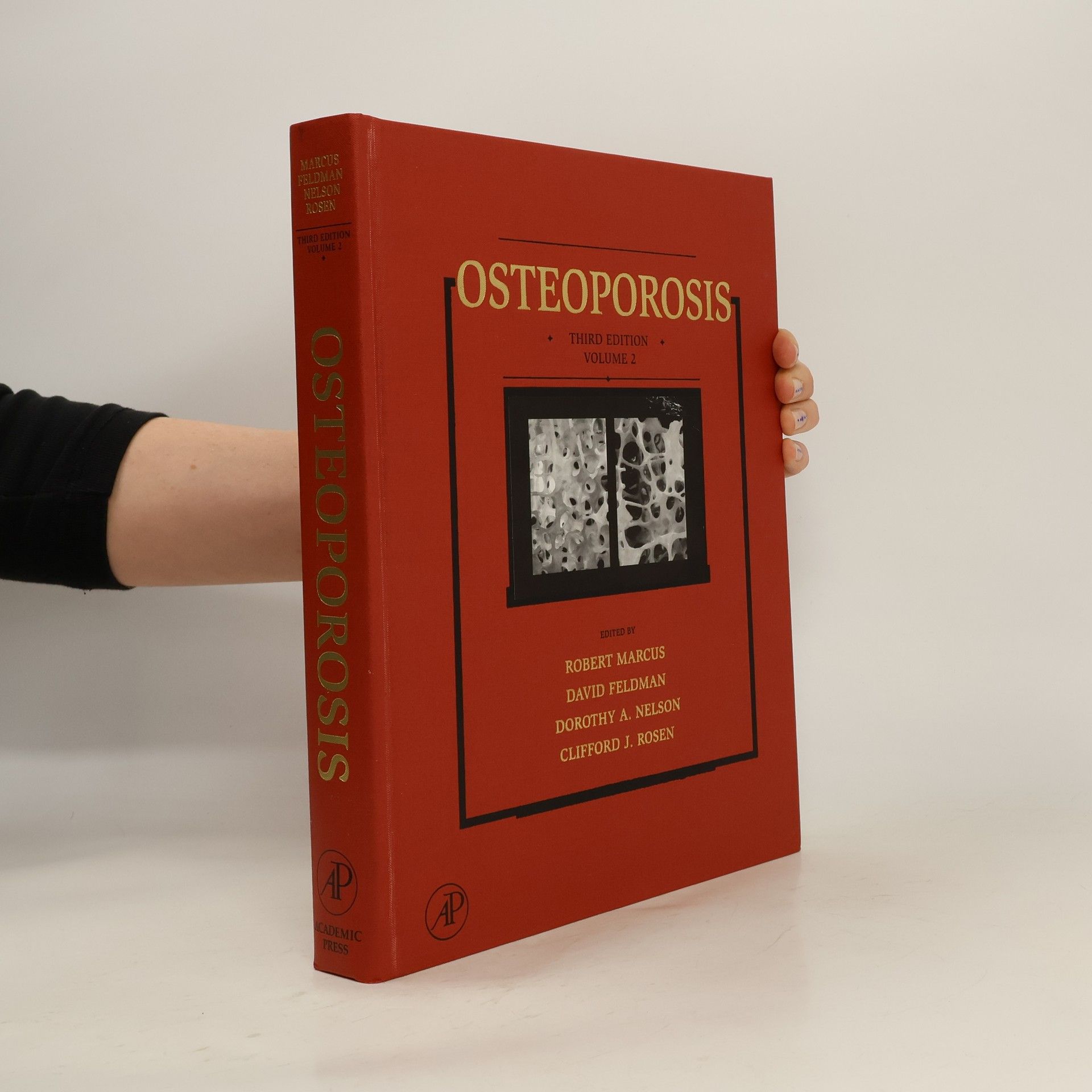 Robert Marcus Osteoporosis