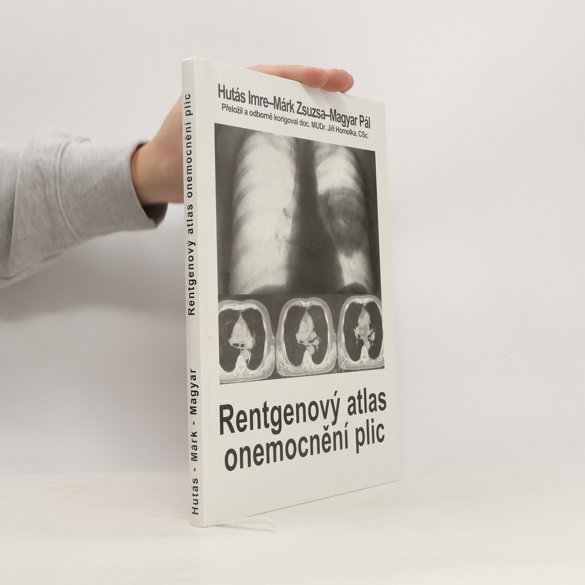 Imre Hutás Rentgenový atlas onemocnění plic