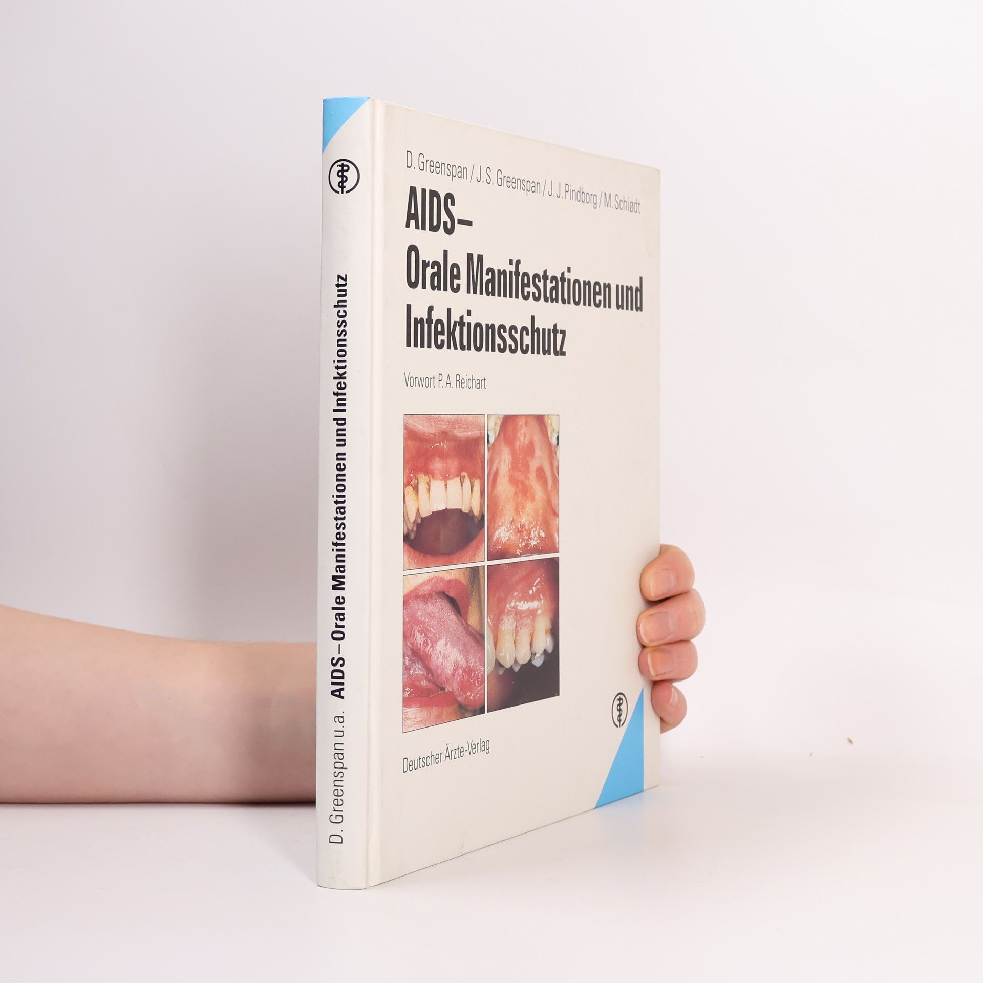 AIDS, orale Manifestationen und Infektionsschutz