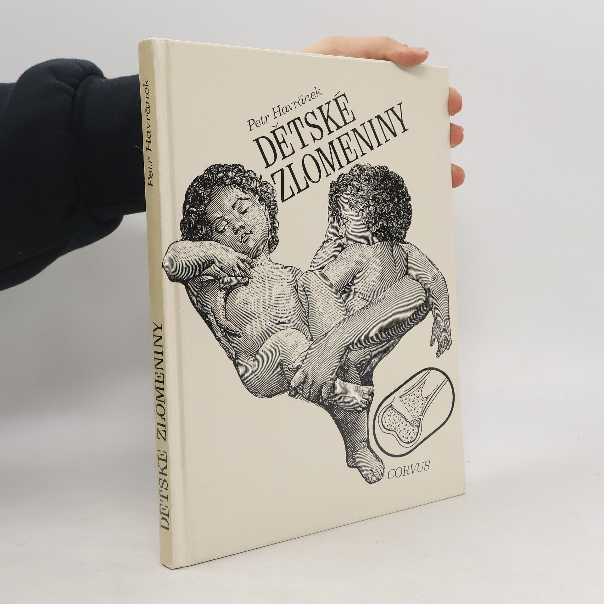 Petr Havránek Dětské zlomeniny