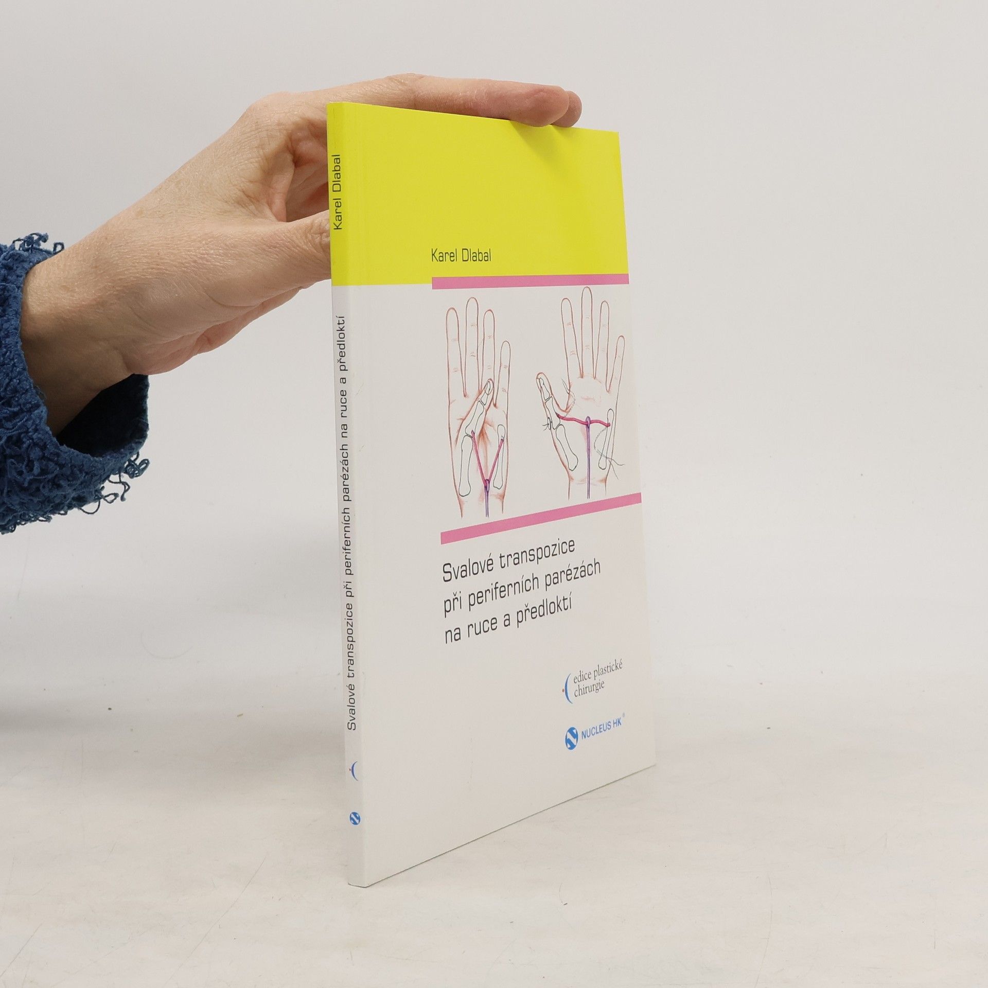 Karel Dlabal Svalové transpozice při periferních parézách na ruce a předloktí