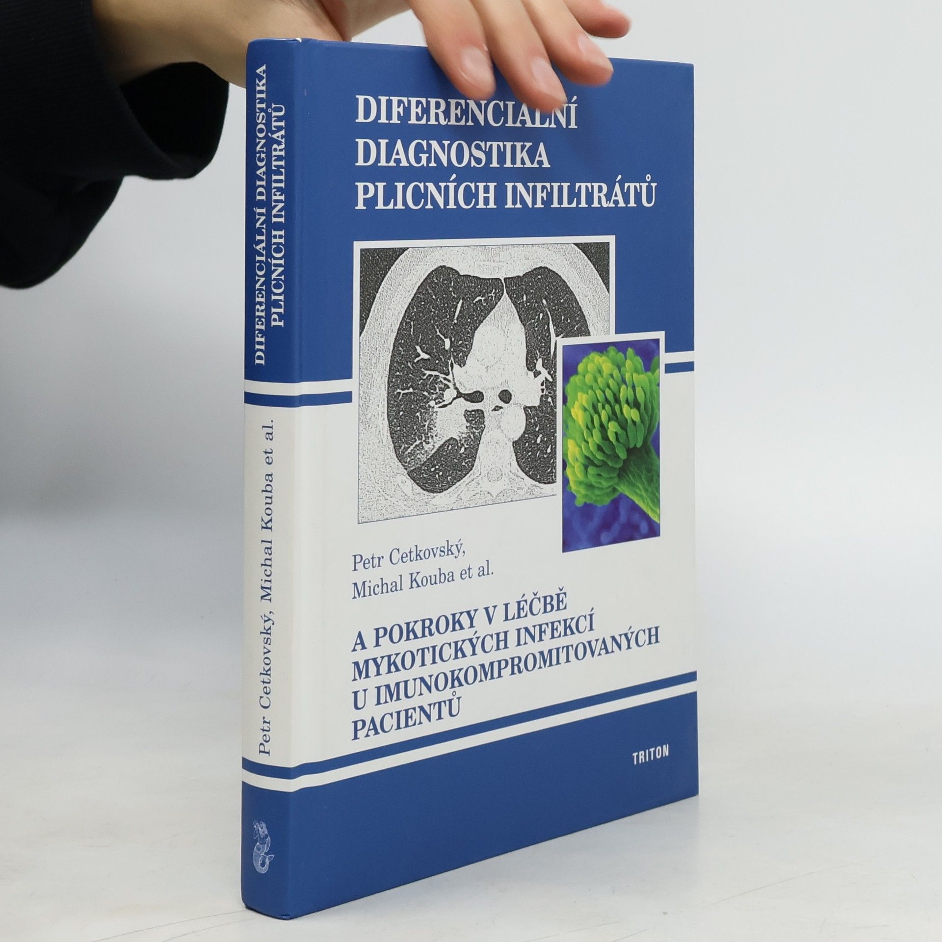Petr Cetkovský Diferenciální diagnostika plicních infiltrátů a pokroky v léčbě mykotických infekcí u imunokompromitovaných pacientů