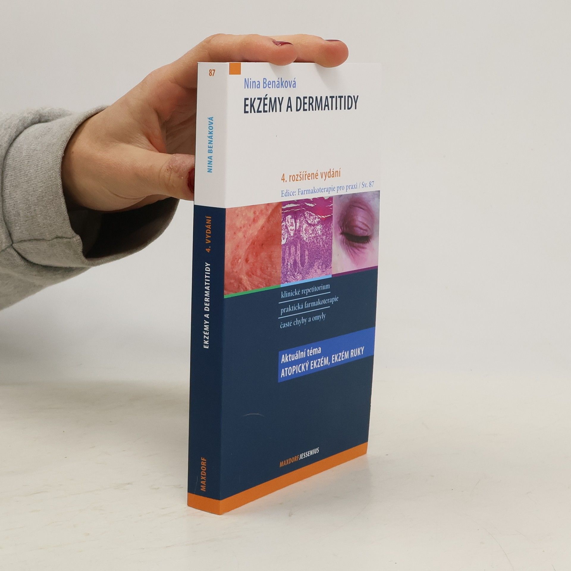 Nina Benáková Ekzémy a dermatitidy