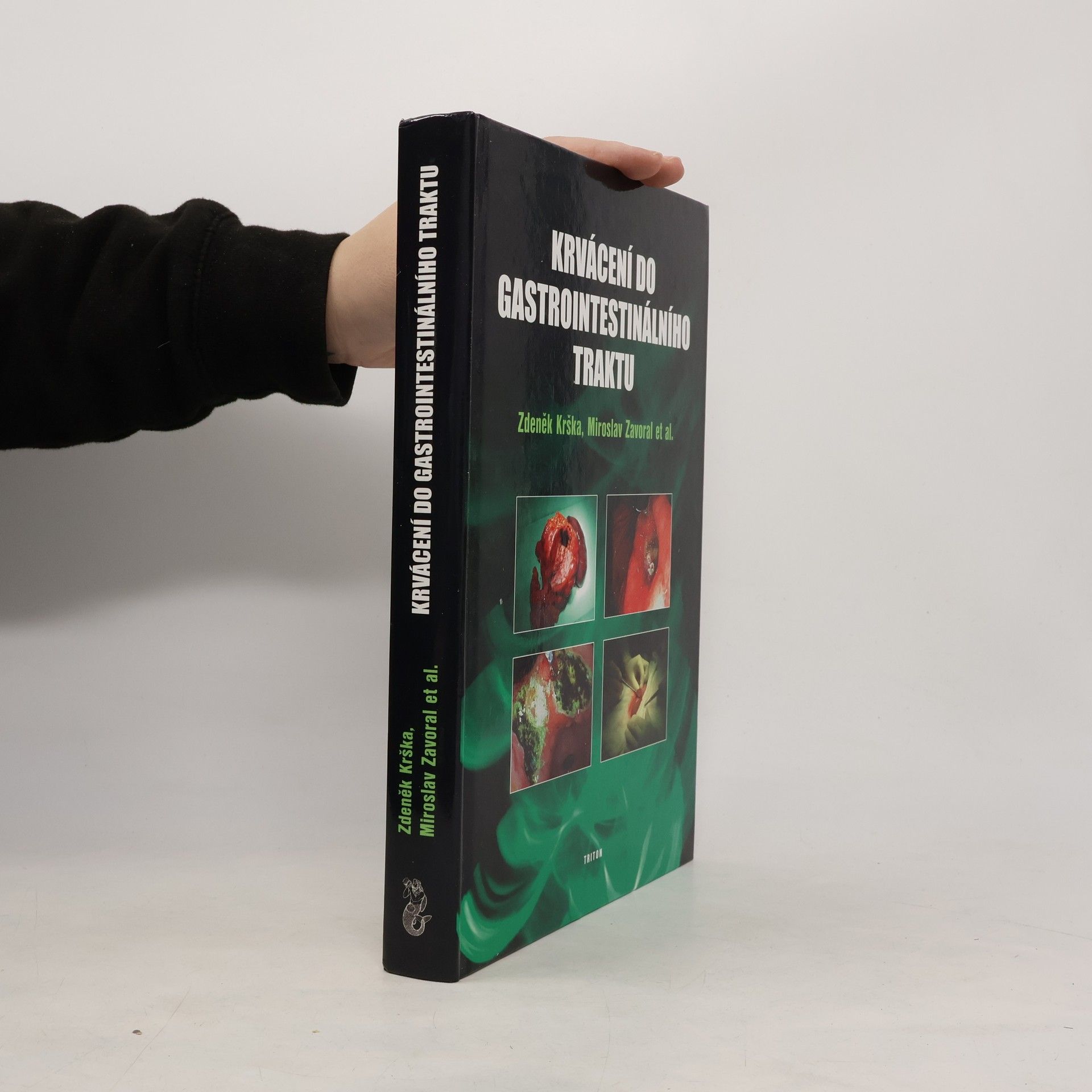 Krvácení do gastrointestinálního traktu