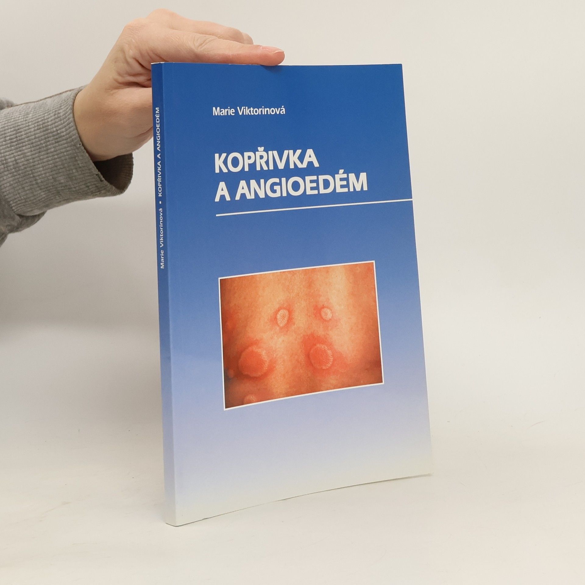 Marie Viktorinová Kopřivka a angioedém