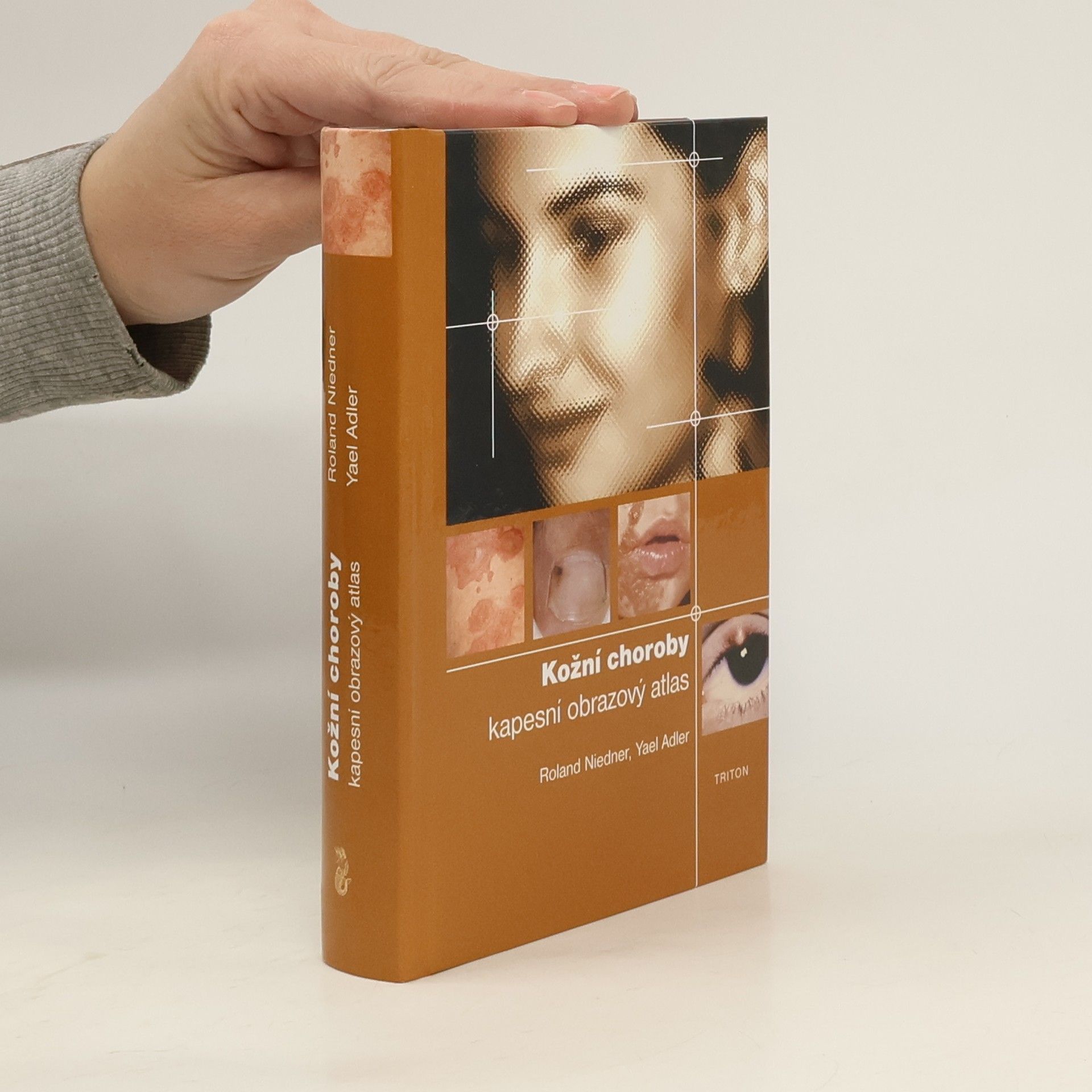 Kožní choroby : kapesní obrazový atlas
